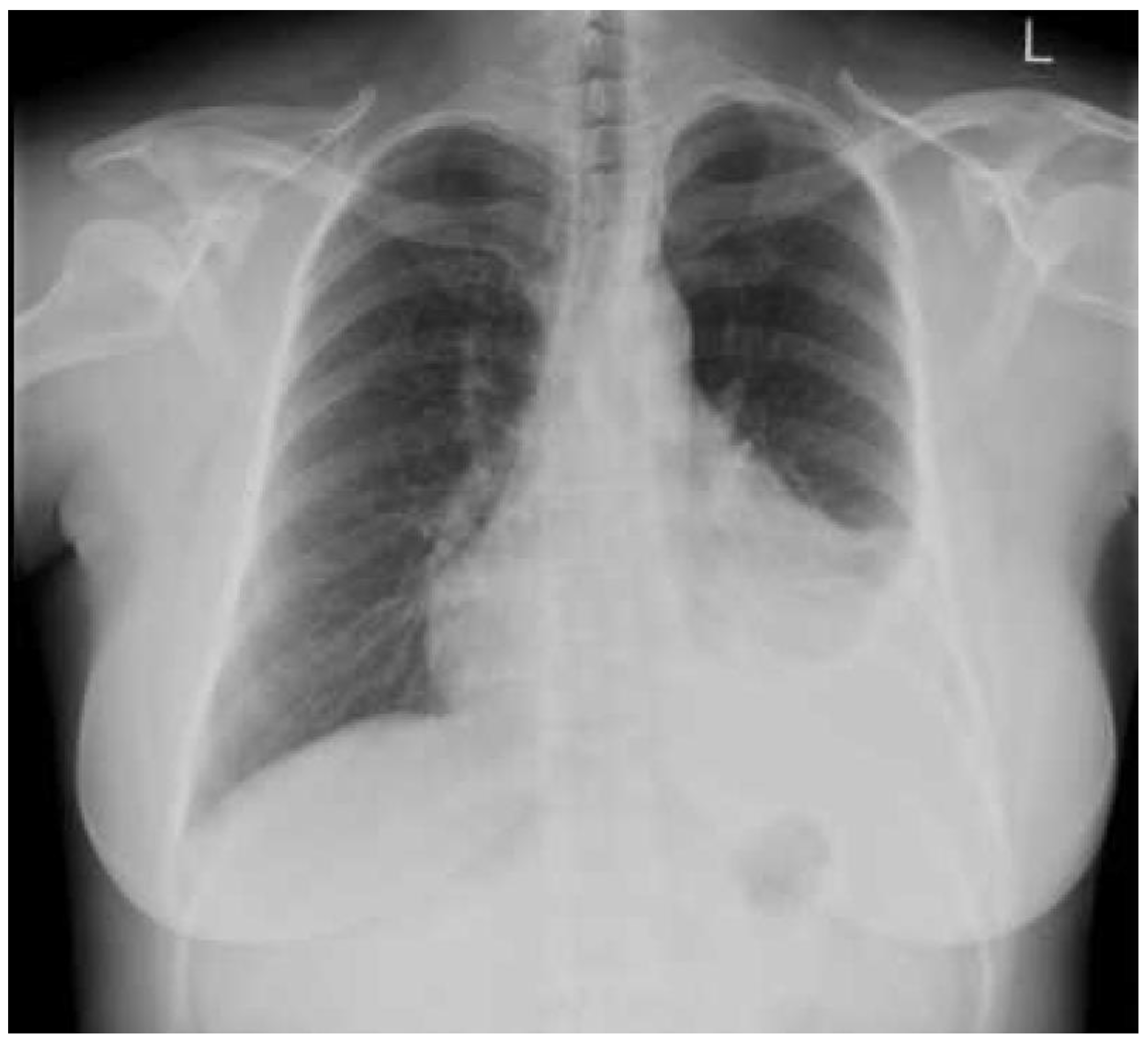 Diagnostics 10 01046 g005 Diagnostics 10 01046 g005