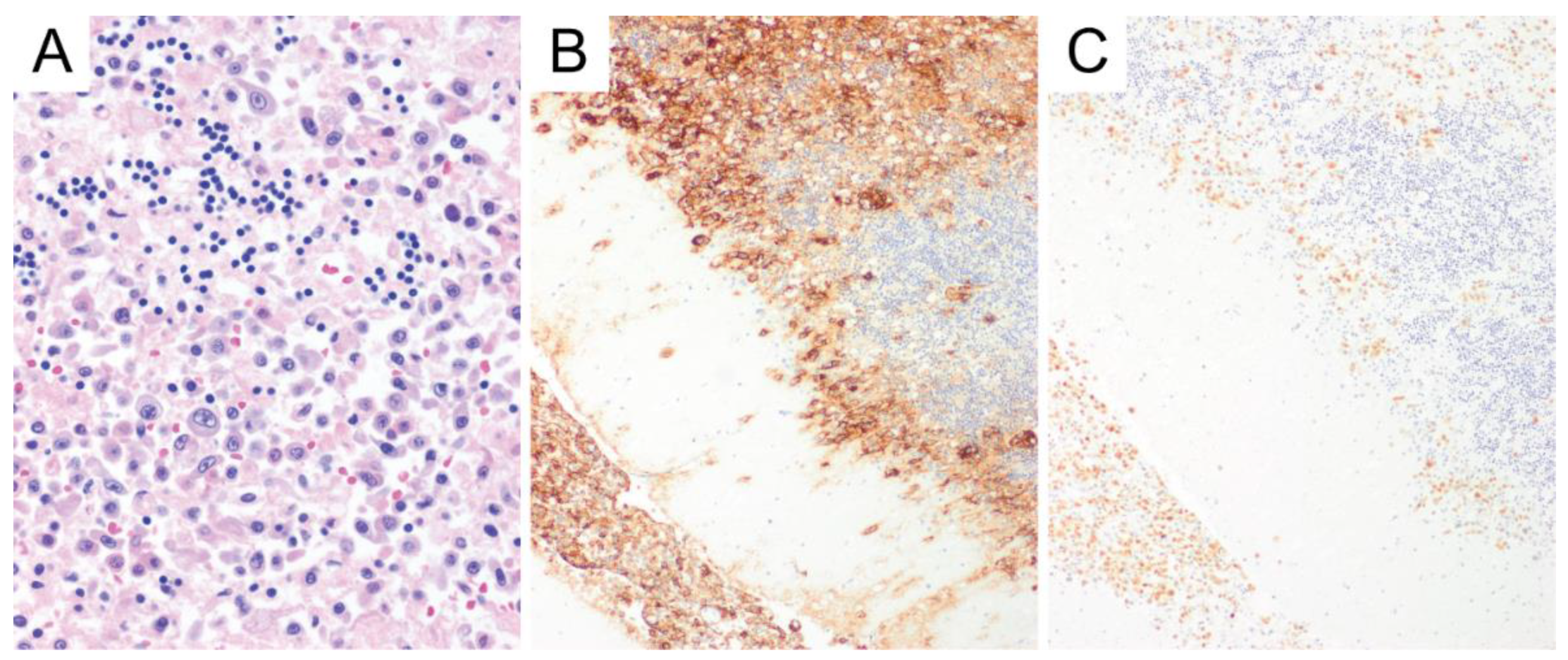 Diagnostics 10 01076 g001 Diagnostics 10 01076 g001