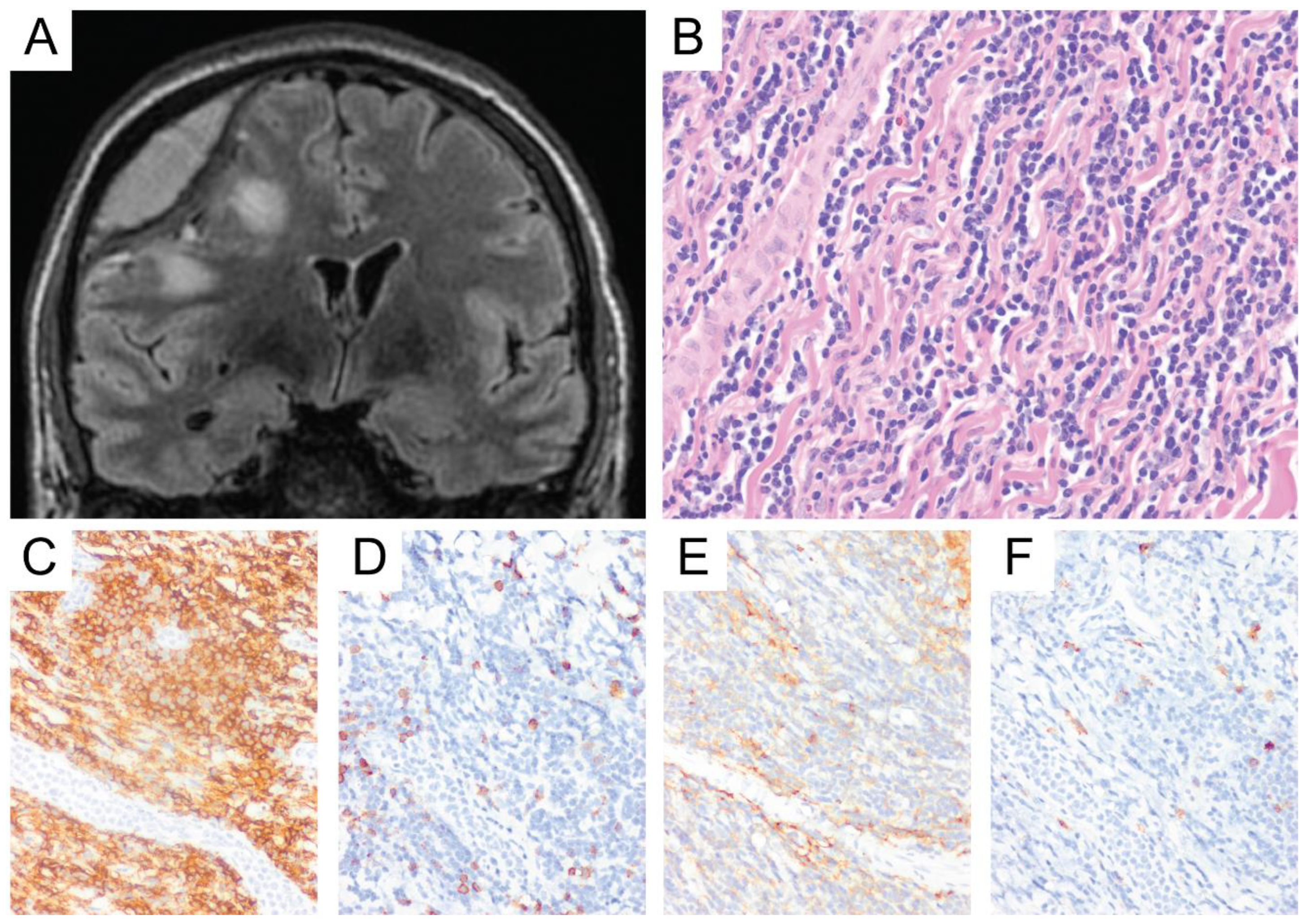 Diagnostics 10 01076 g007 Diagnostics 10 01076 g007