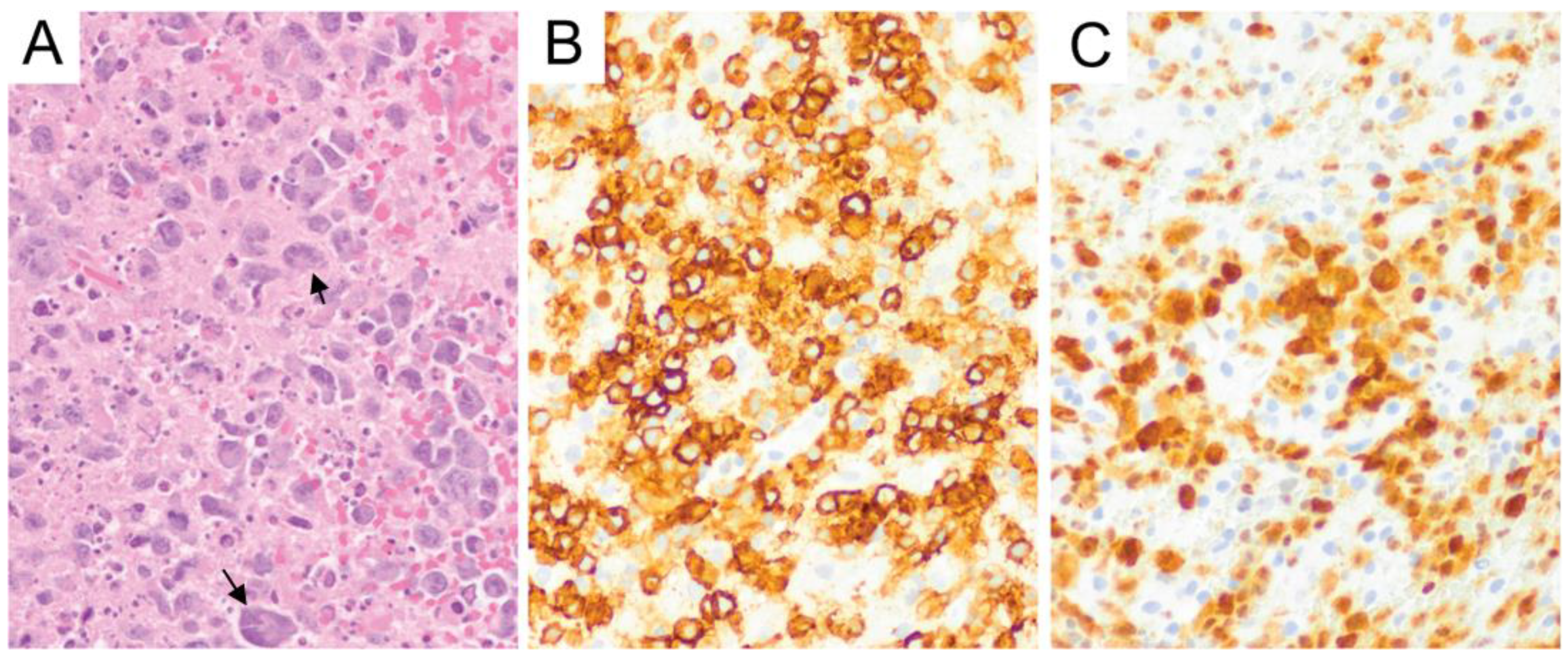 Diagnostics 10 01076 g009 Diagnostics 10 01076 g009