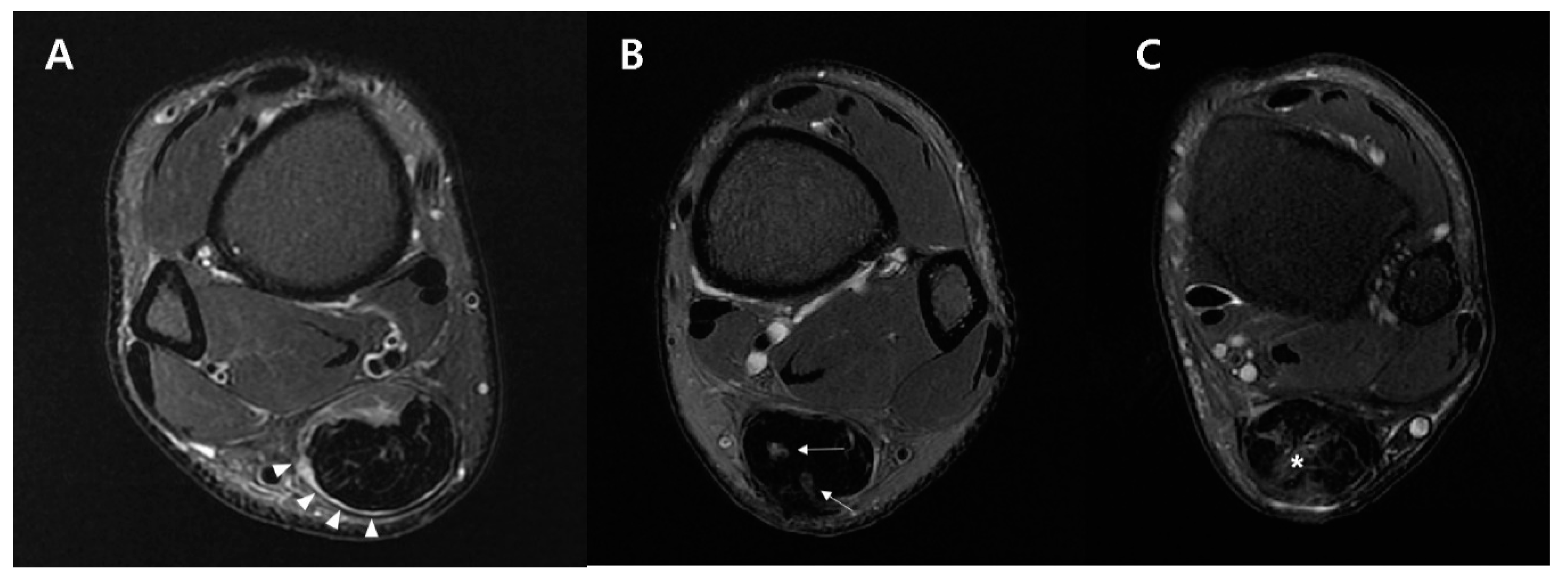 Diagnostics 10 01085 g004