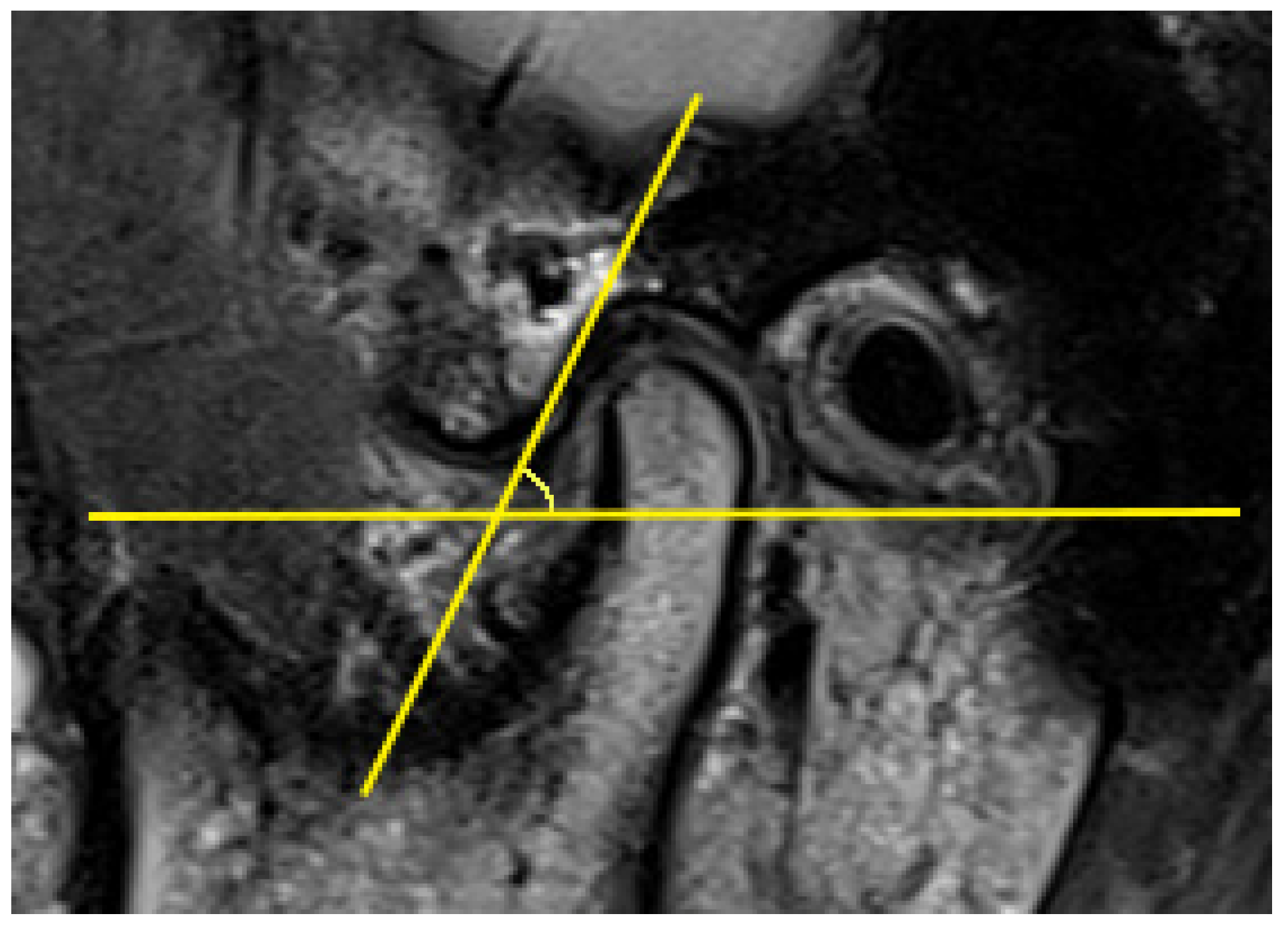 Diagnostics 11 00029 g003 Diagnostics 11 00029 g003