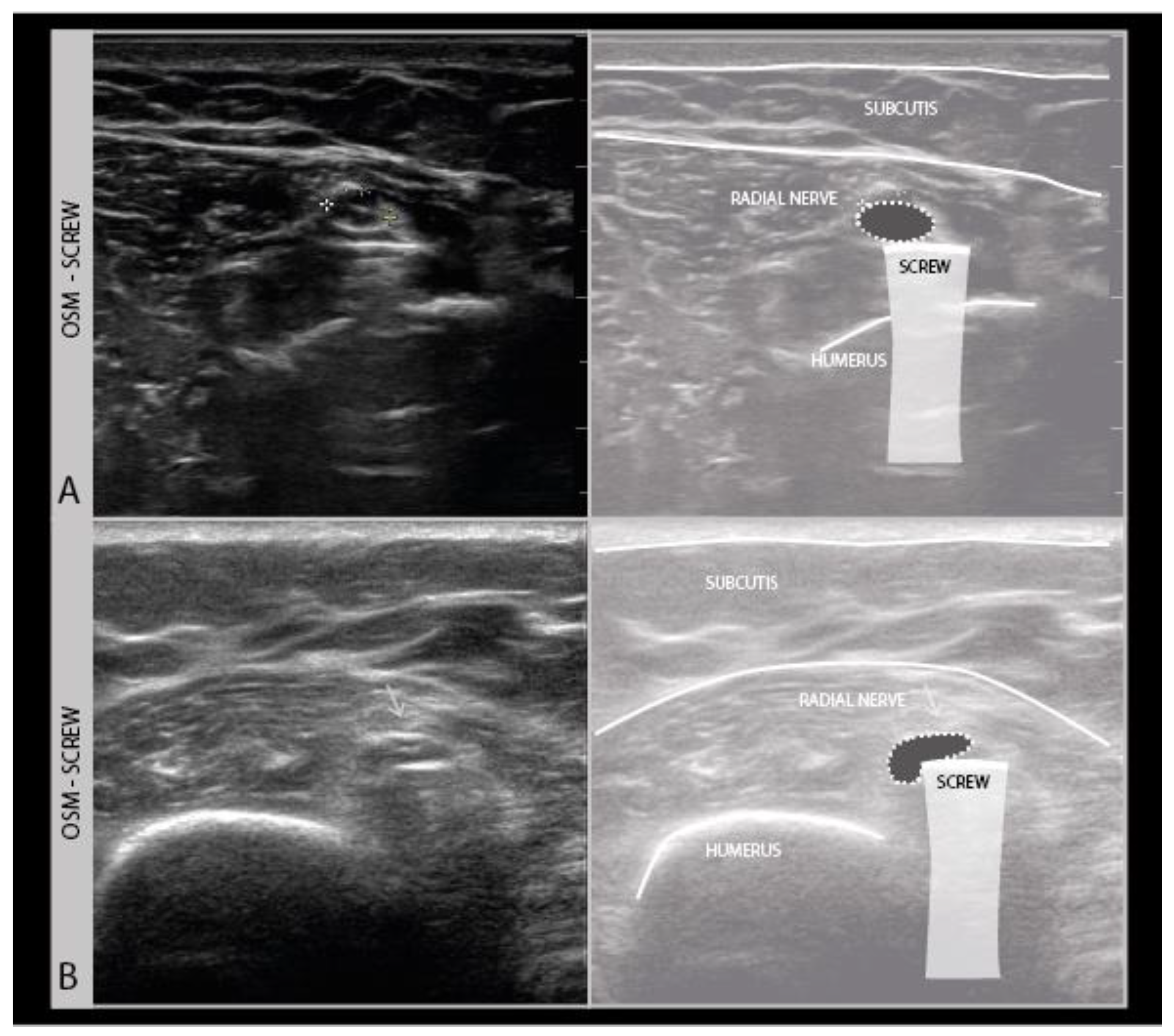 Diagnostics 11 00030 g004