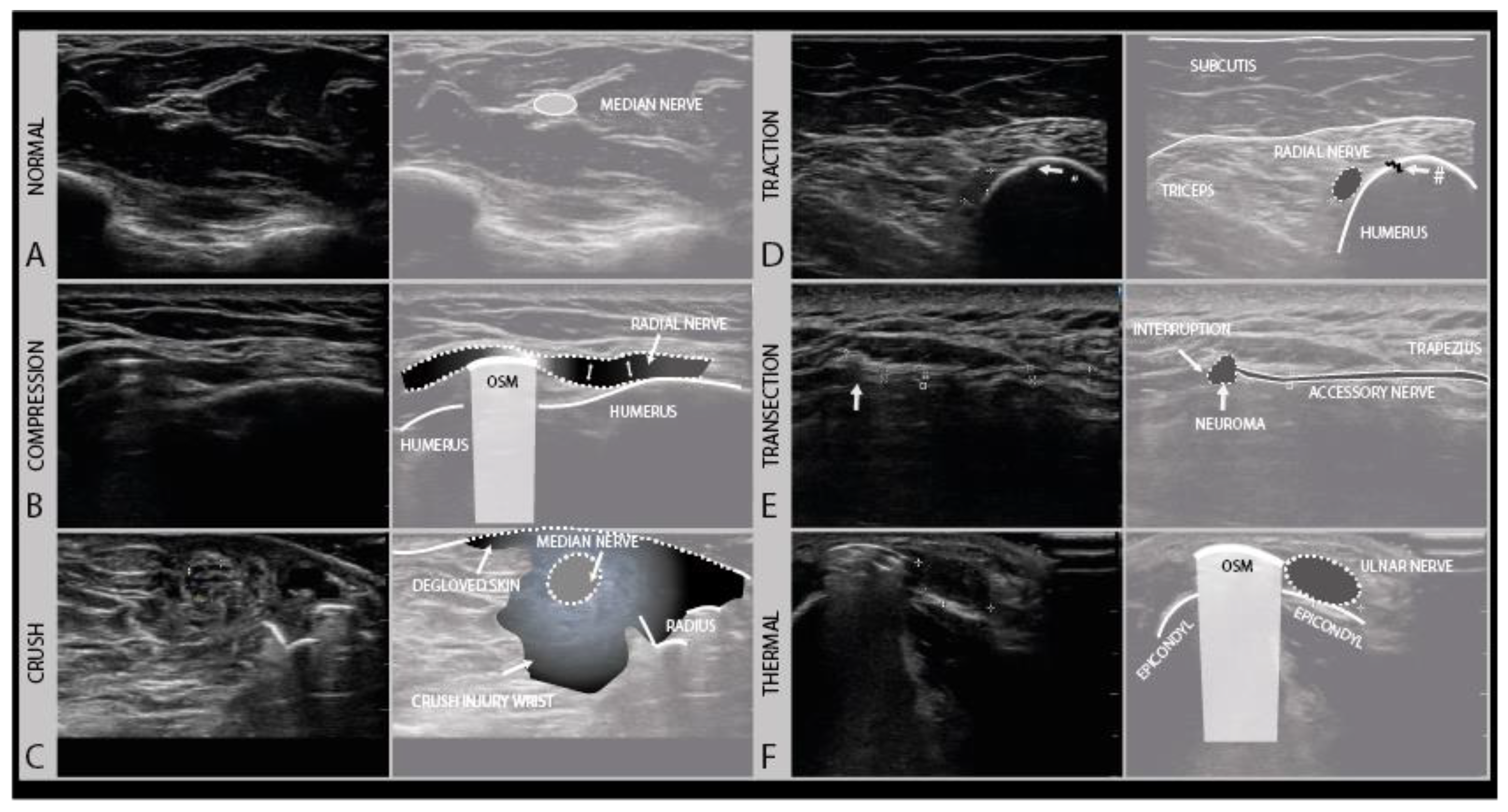Diagnostics 11 00030 g007