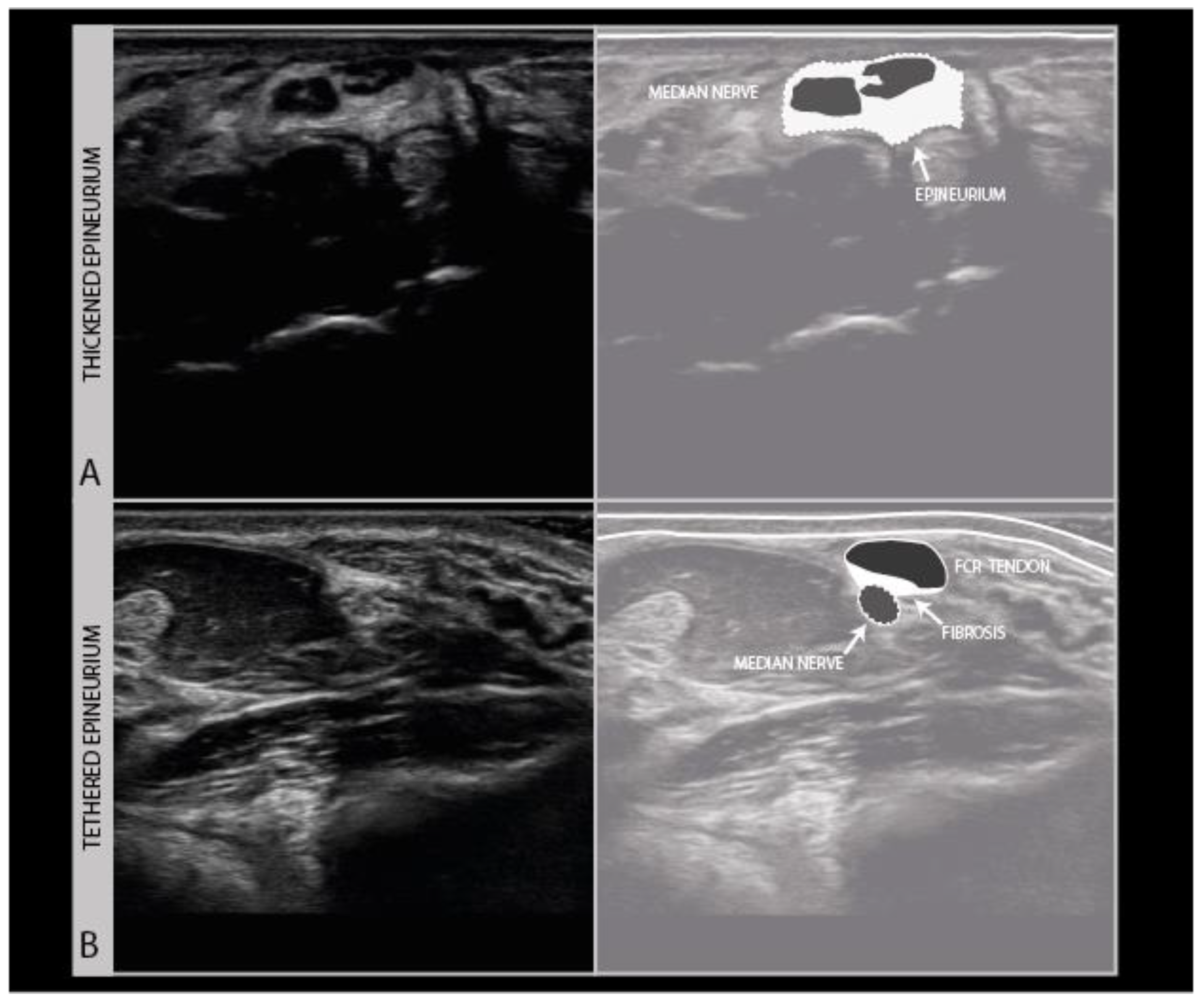 Diagnostics 11 00030 g009