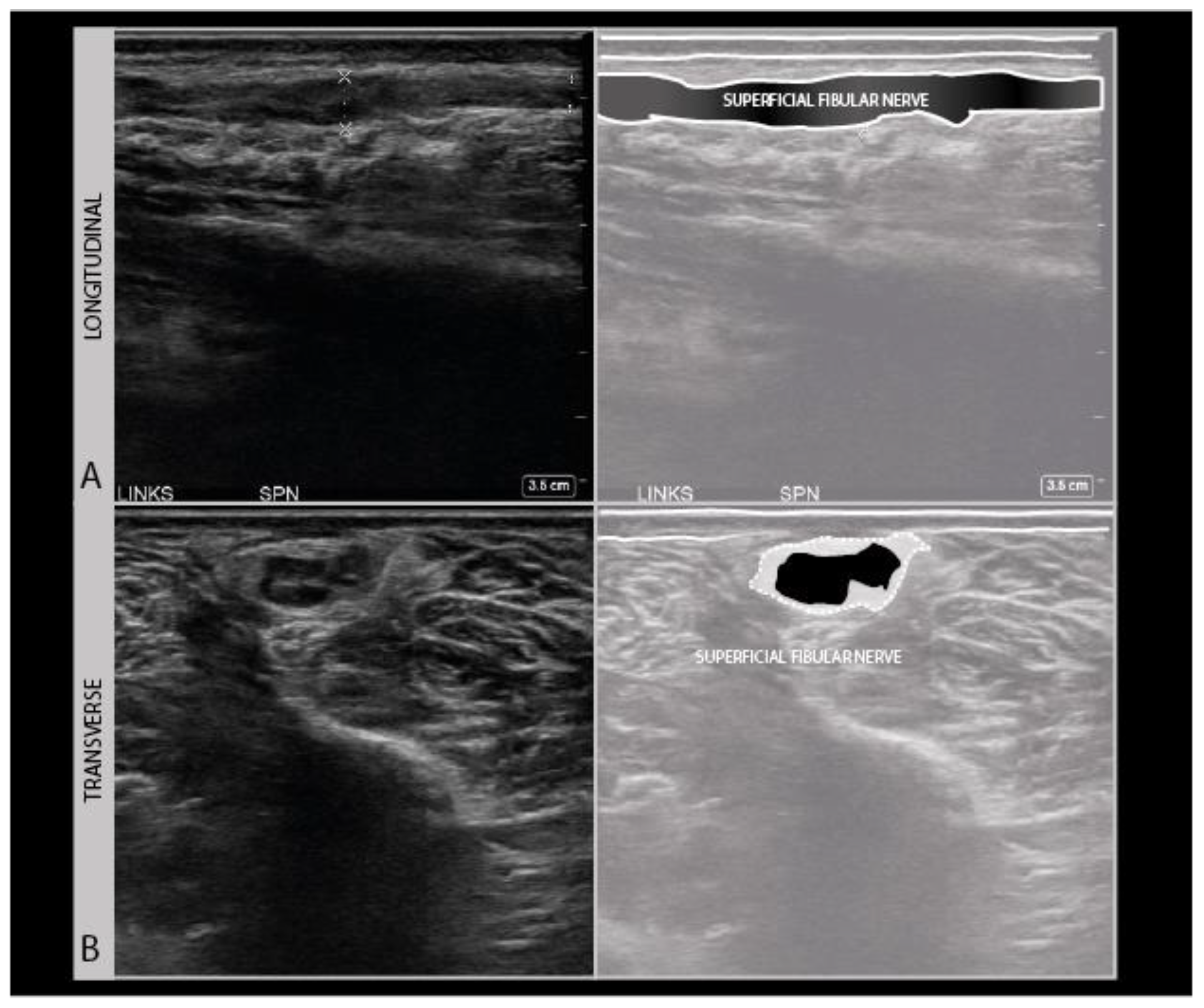 Diagnostics 11 00030 g010