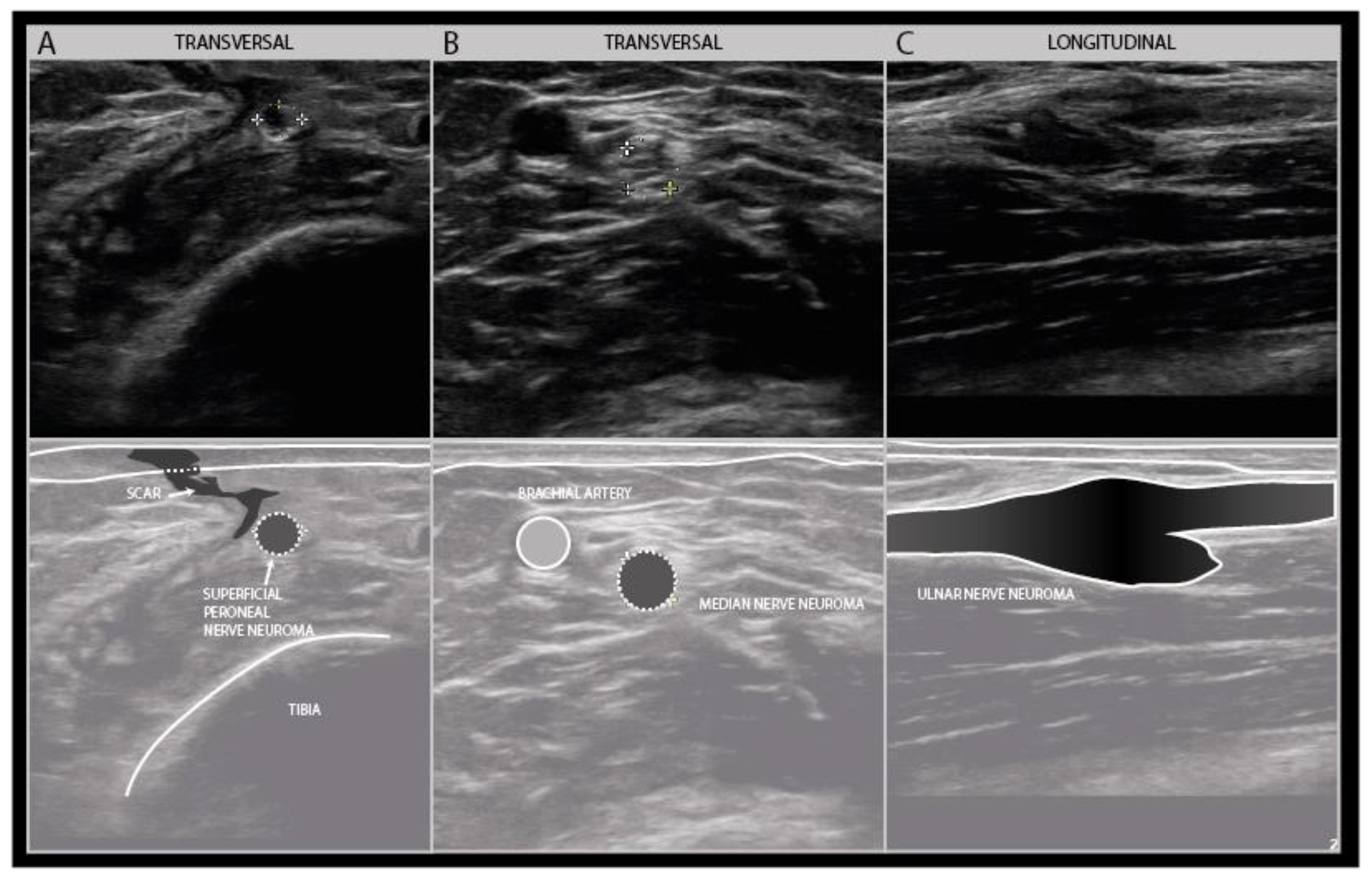 Diagnostics 11 00030 g014