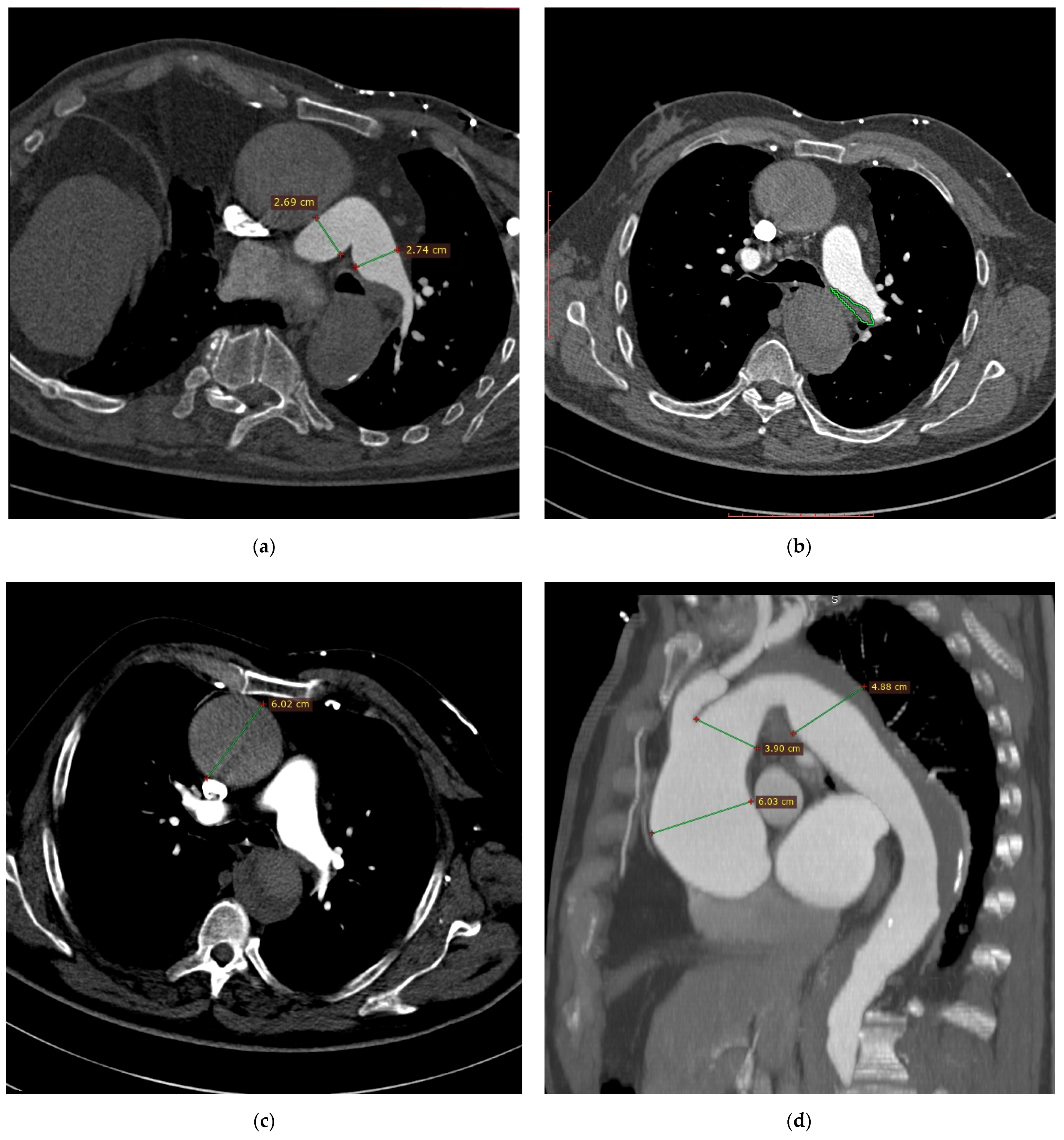 Diagnostics 11 00056 g001a Diagnostics 11 00056 g001a