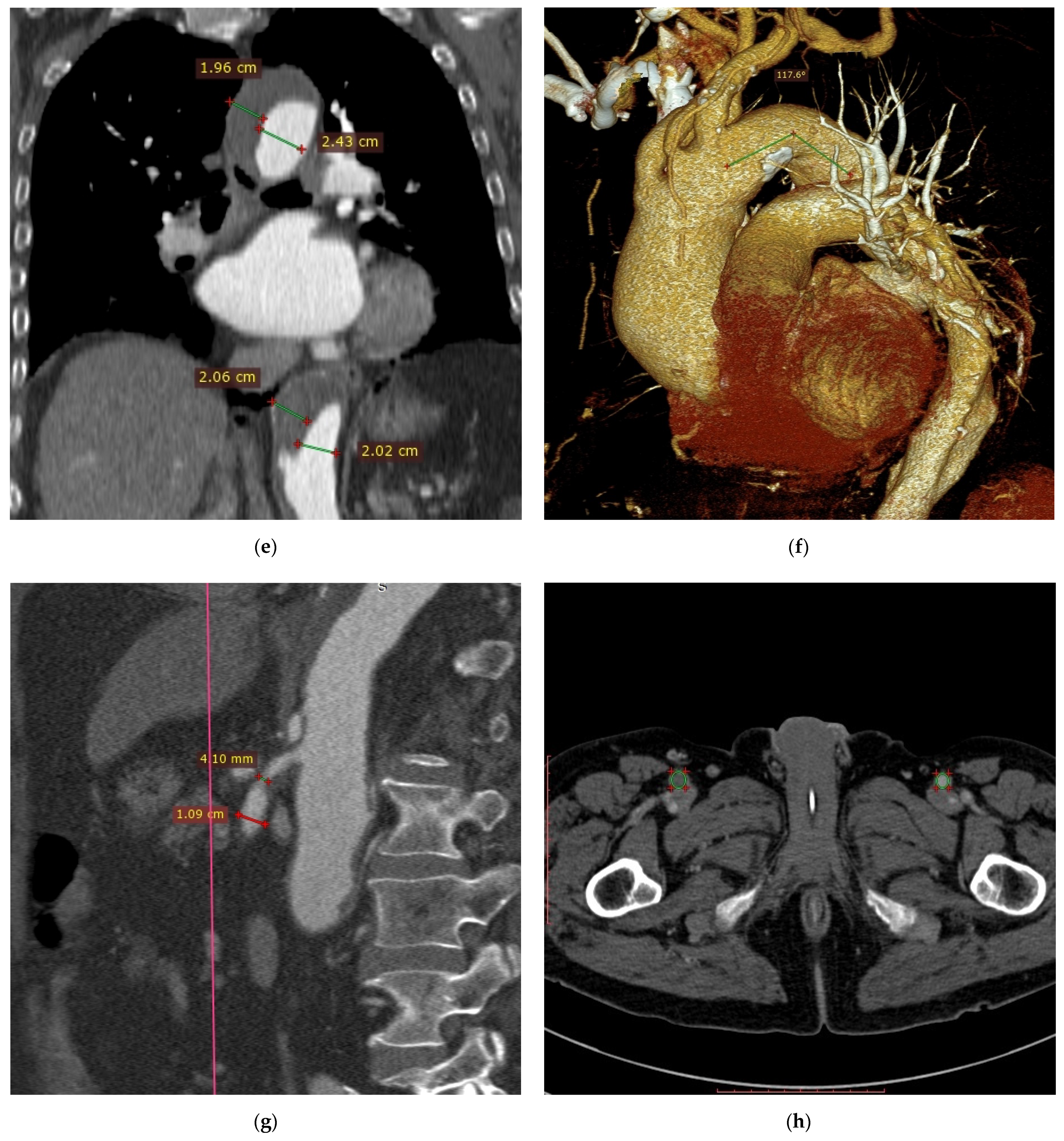 Diagnostics 11 00056 g001b Diagnostics 11 00056 g001b