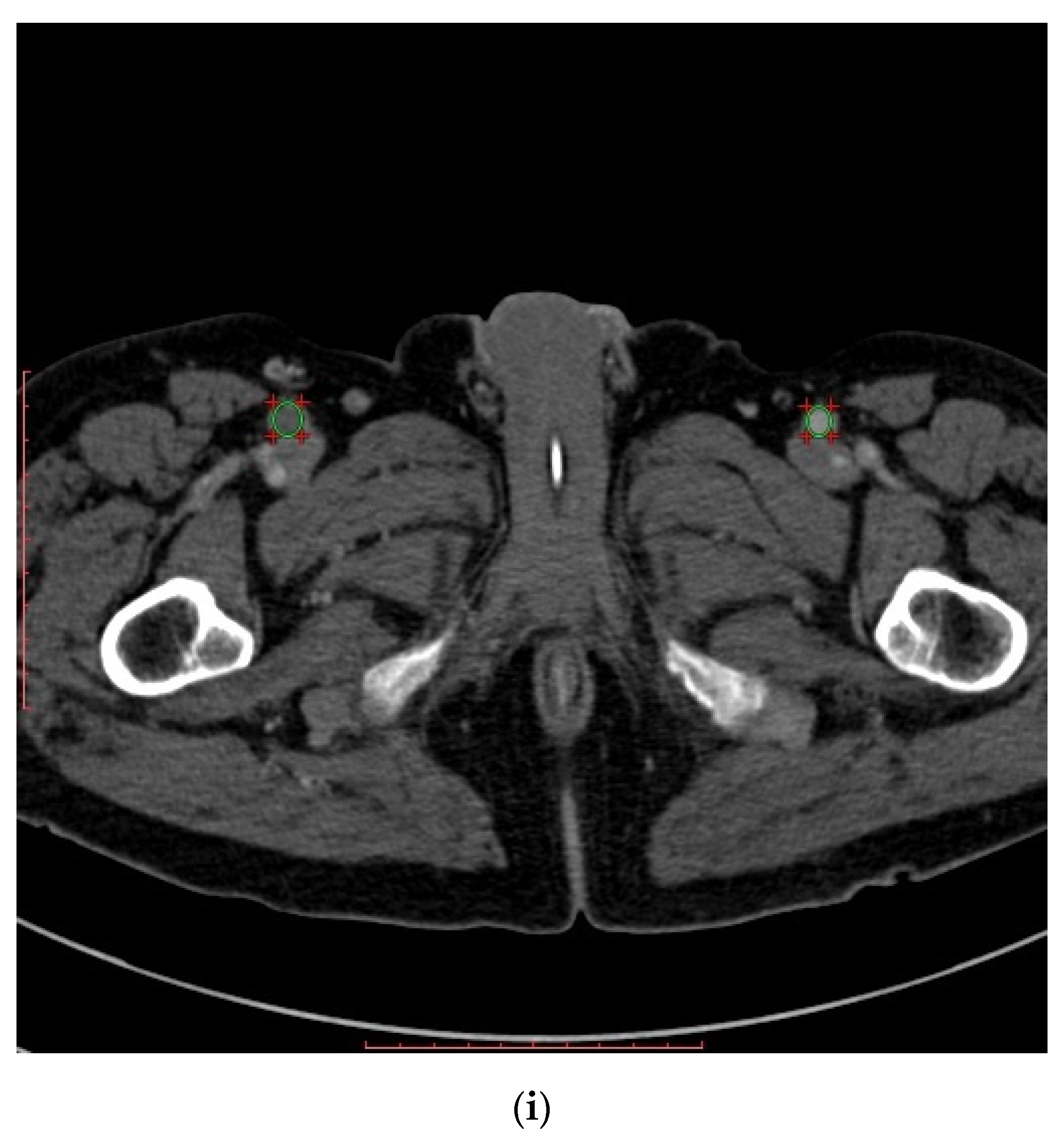 Diagnostics 11 00056 g001c Diagnostics 11 00056 g001c