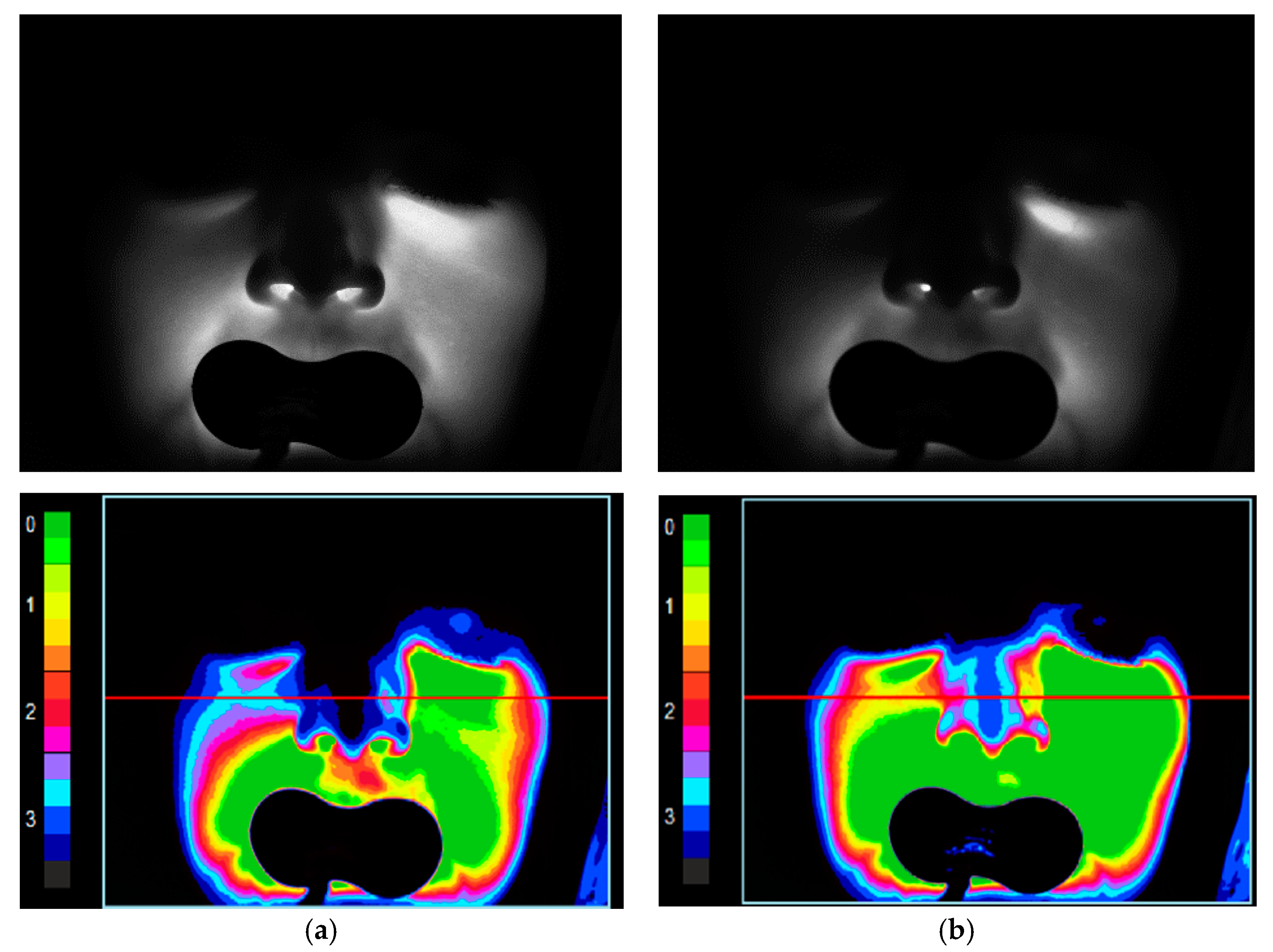 Diagnostics 11 00077 g003