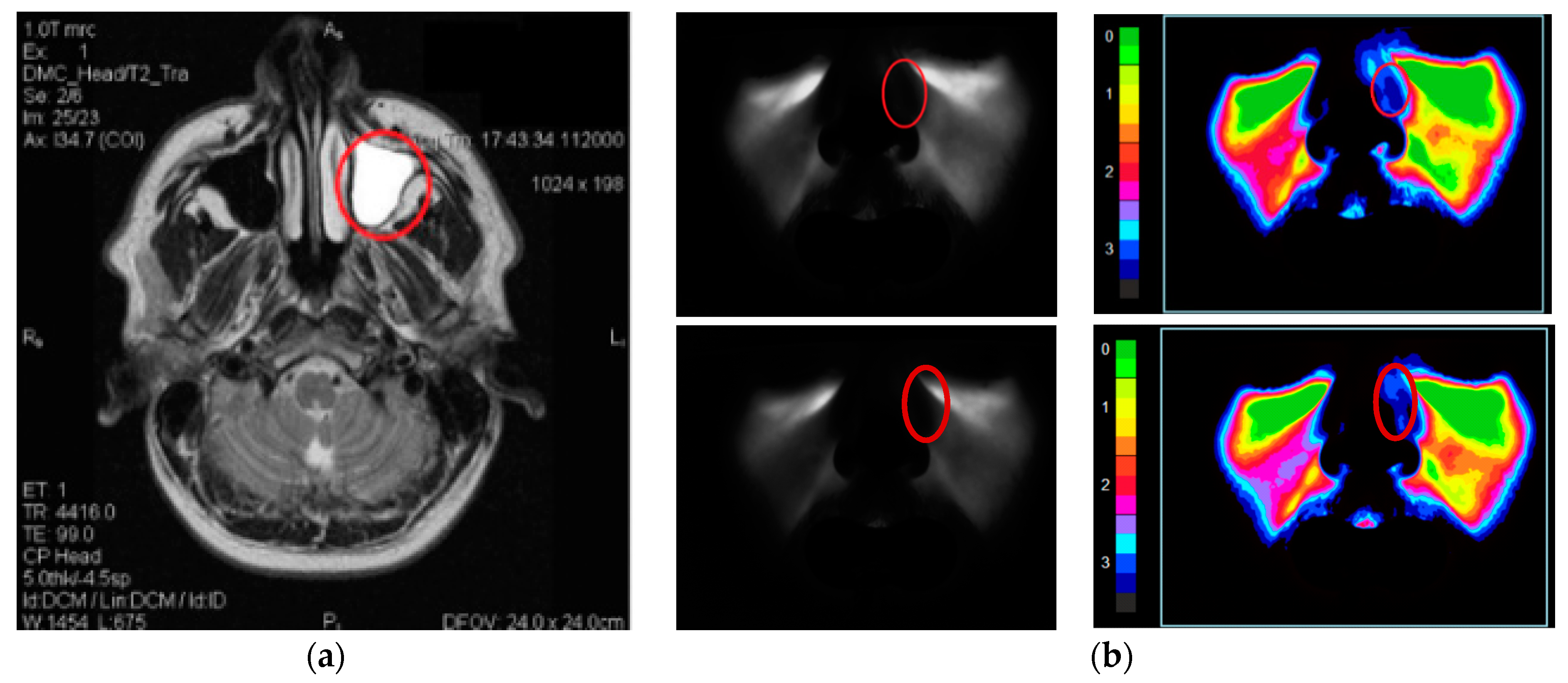 Diagnostics 11 00077 g004