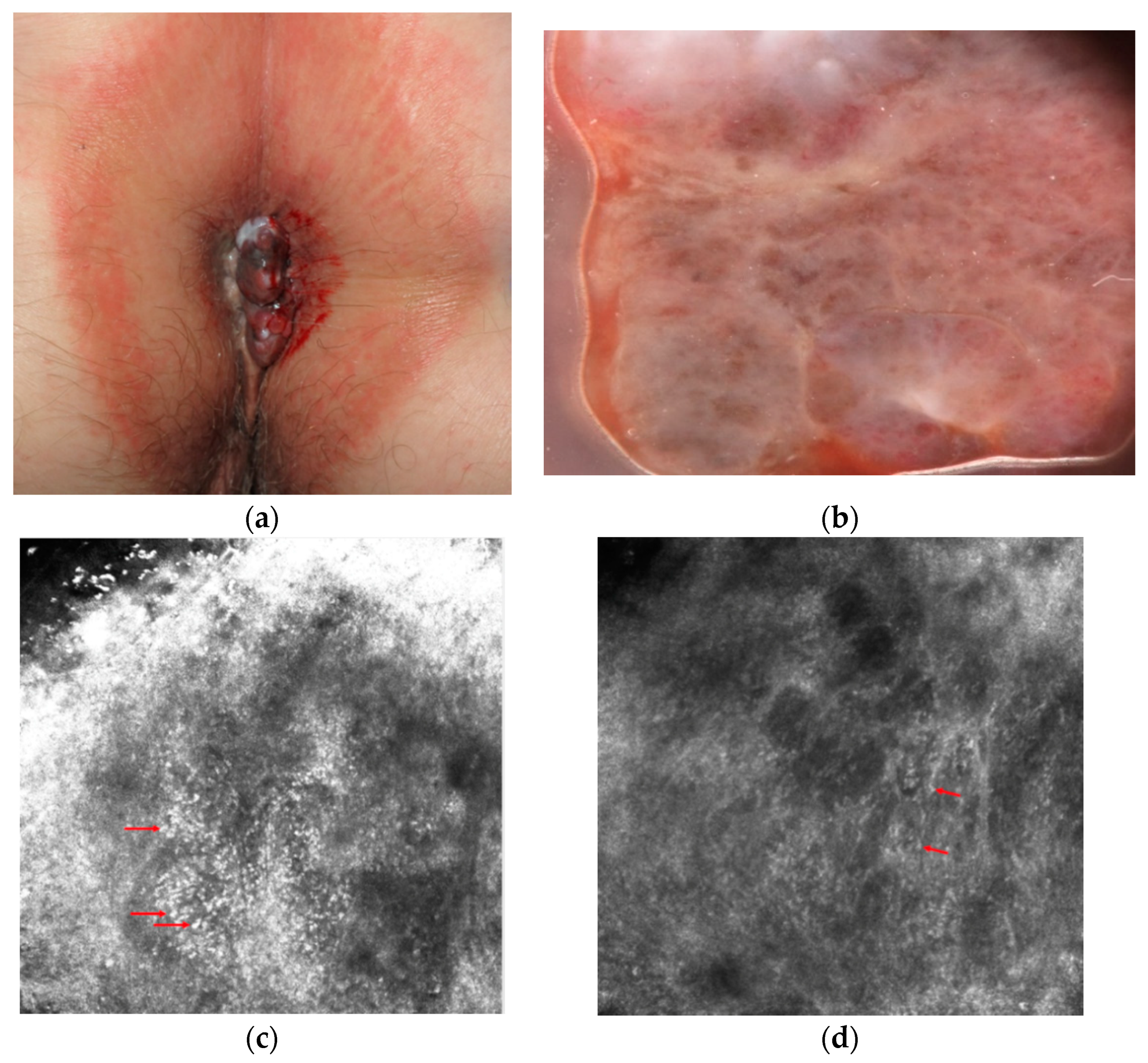 Diagnostics 11 00091 g001