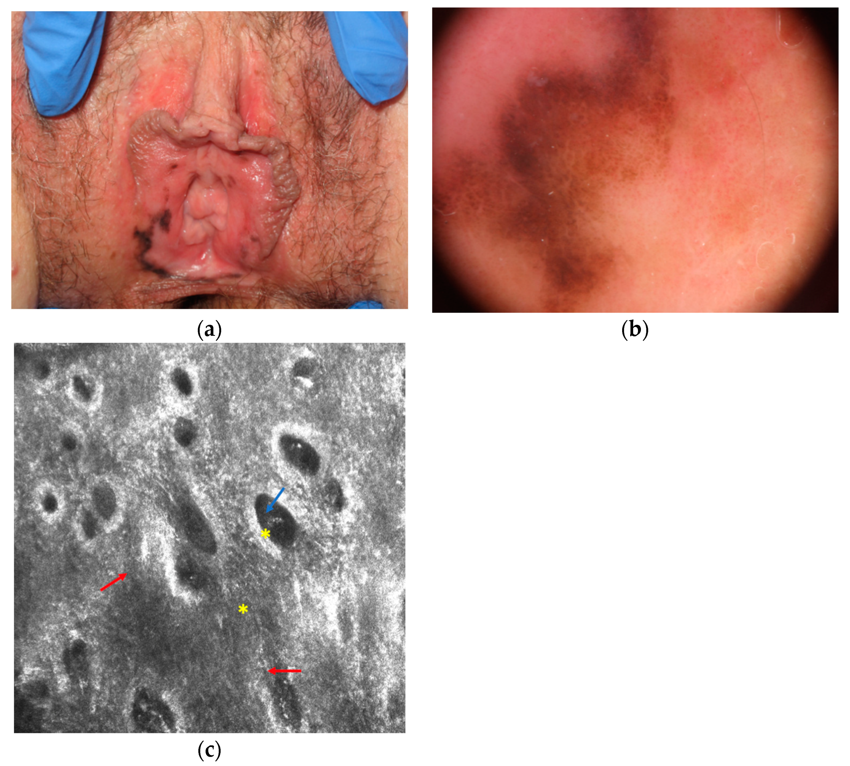 Diagnostics 11 00091 g002