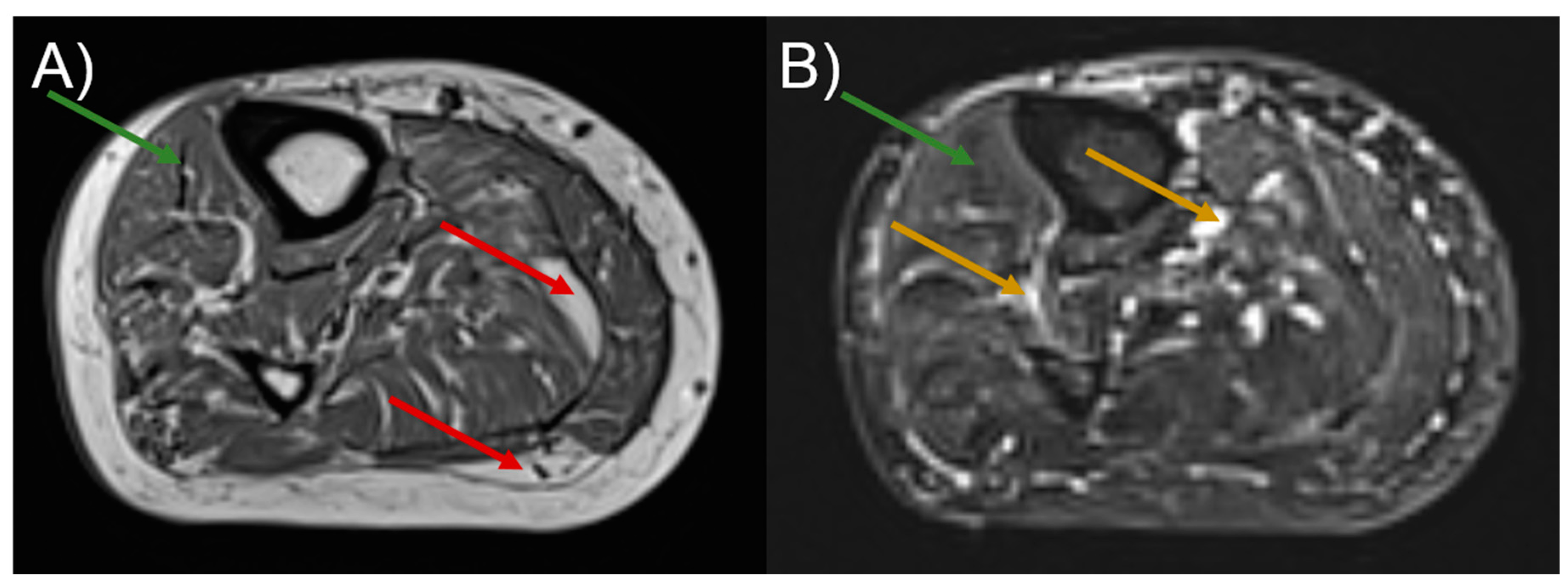 Diagnostics 11 00092 g002