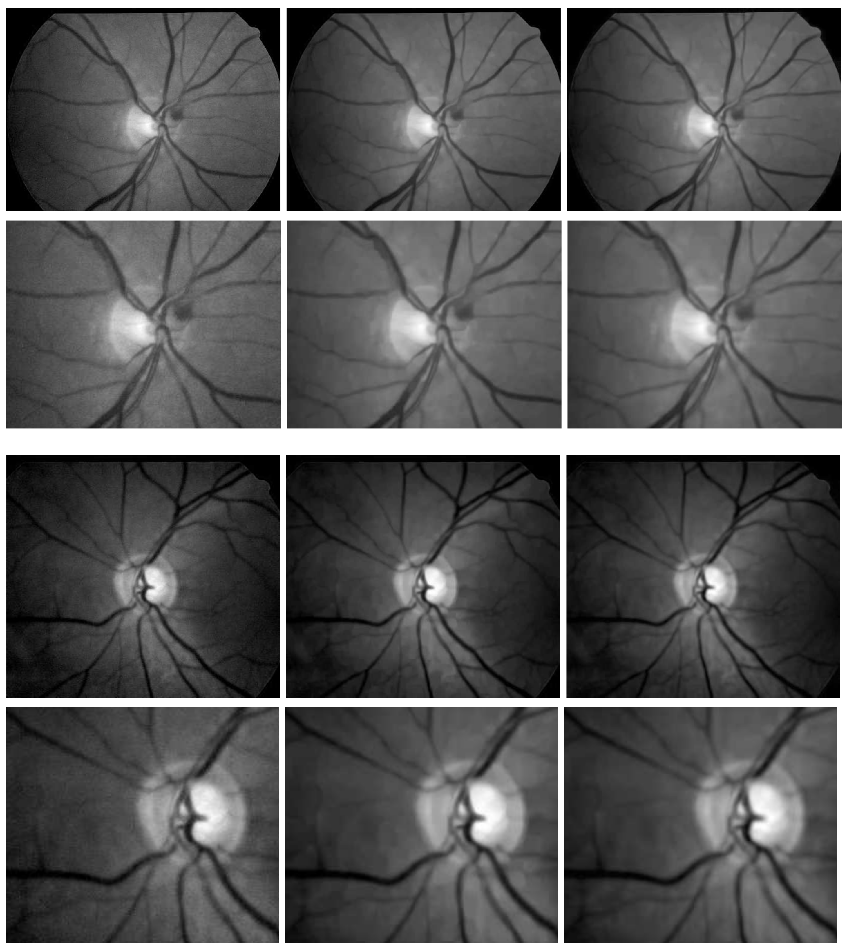 Diagnostics 11 00114 g004