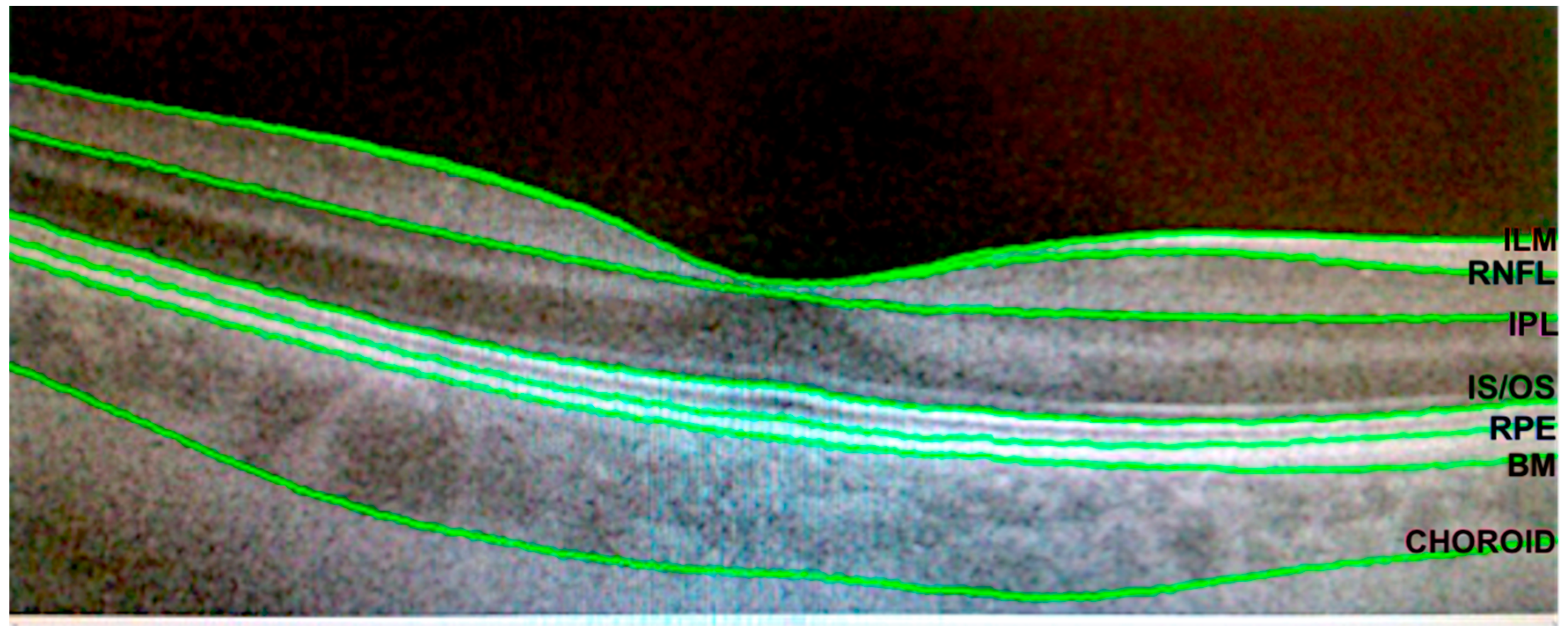 Diagnostics 11 00136 g001