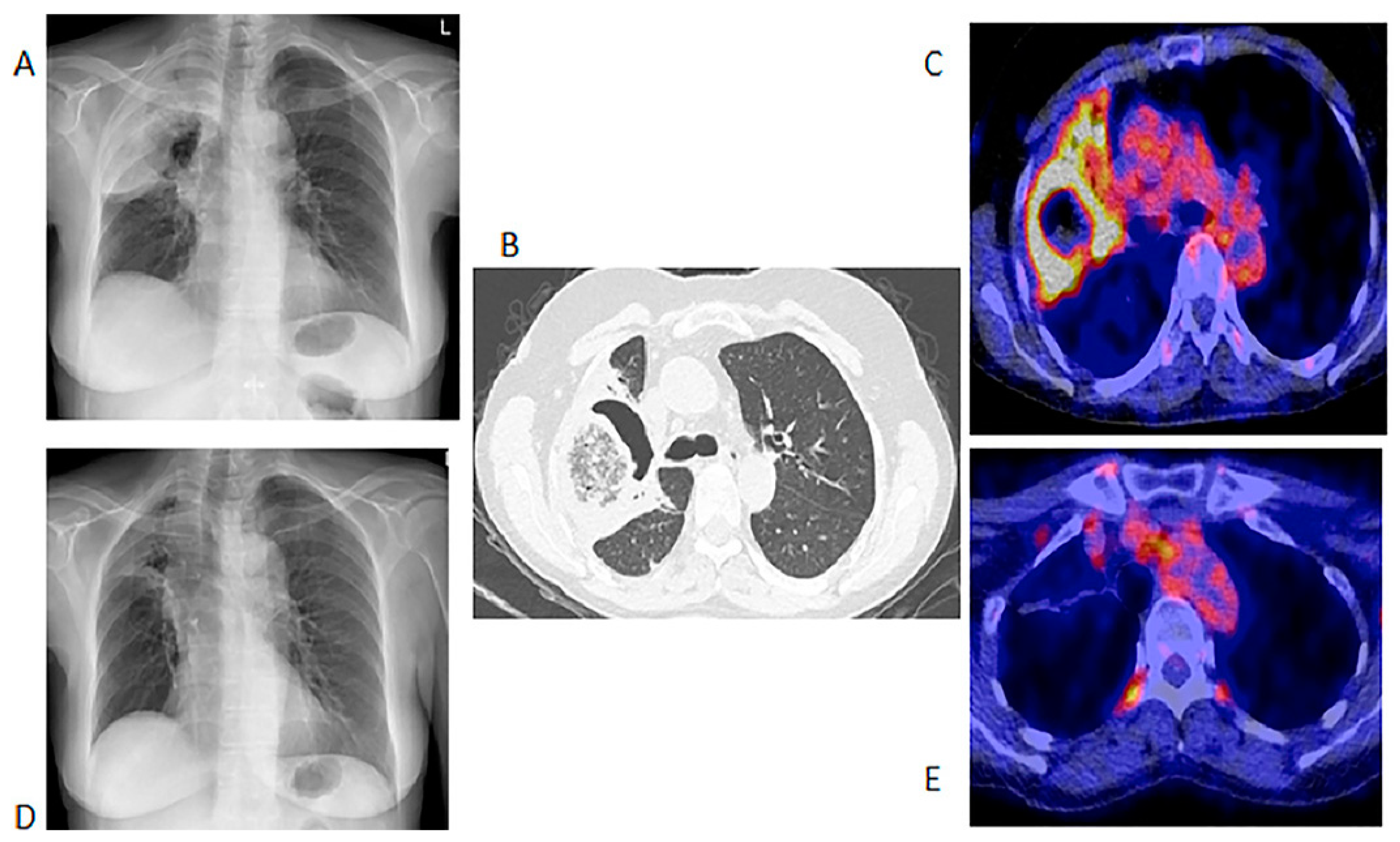 Diagnostics 11 00137 g001 Diagnostics 11 00137 g001