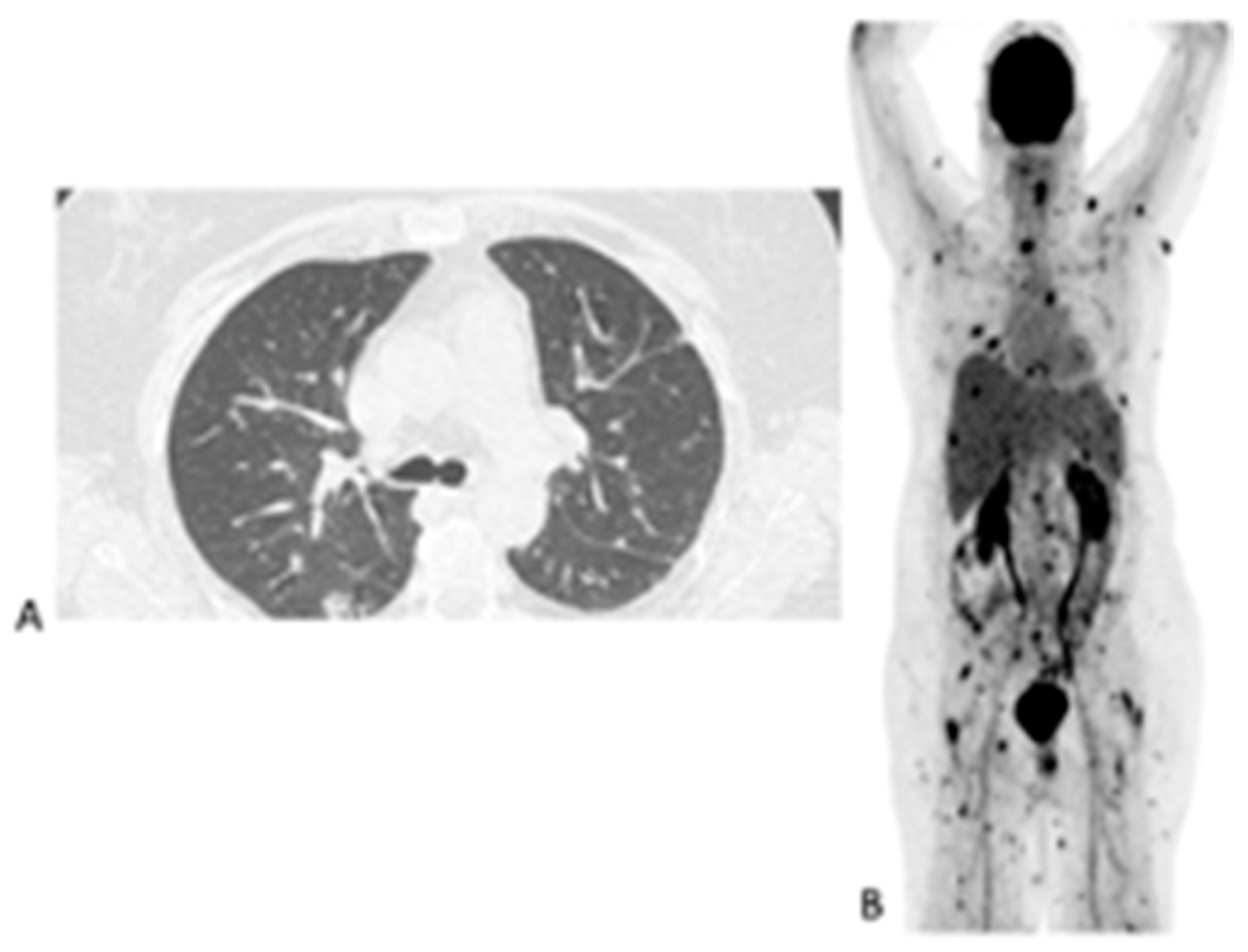 Diagnostics 11 00137 g004 Diagnostics 11 00137 g004