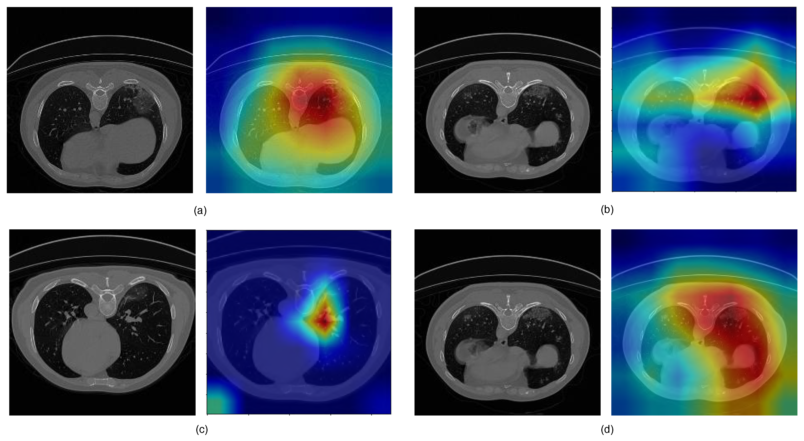 Diagnostics 11 00158 g012