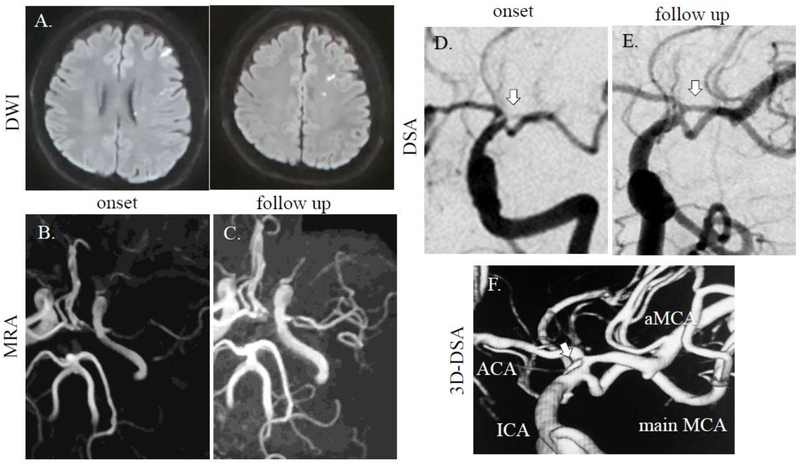 Diagnostics 11 00205 g001