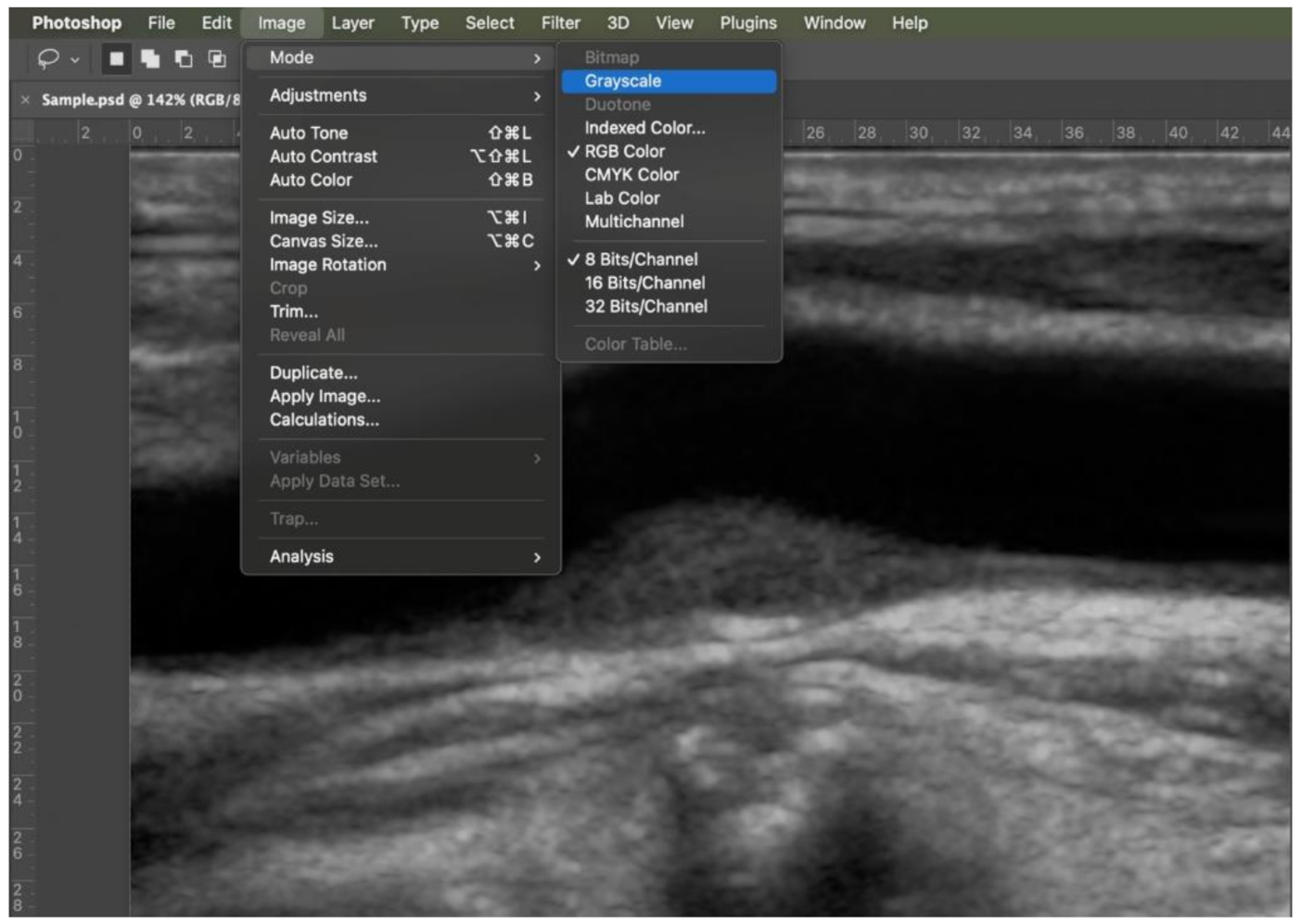 Diagnostics 11 00229 g002