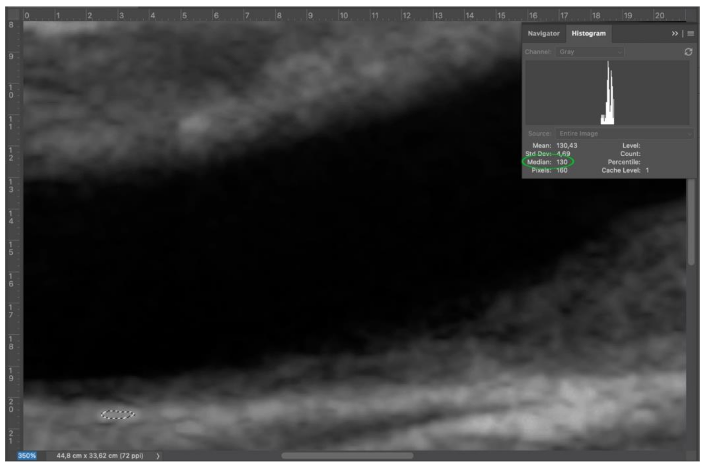 Diagnostics 11 00229 g003