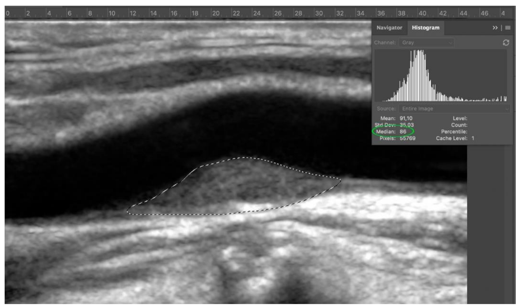 Diagnostics 11 00229 g005
