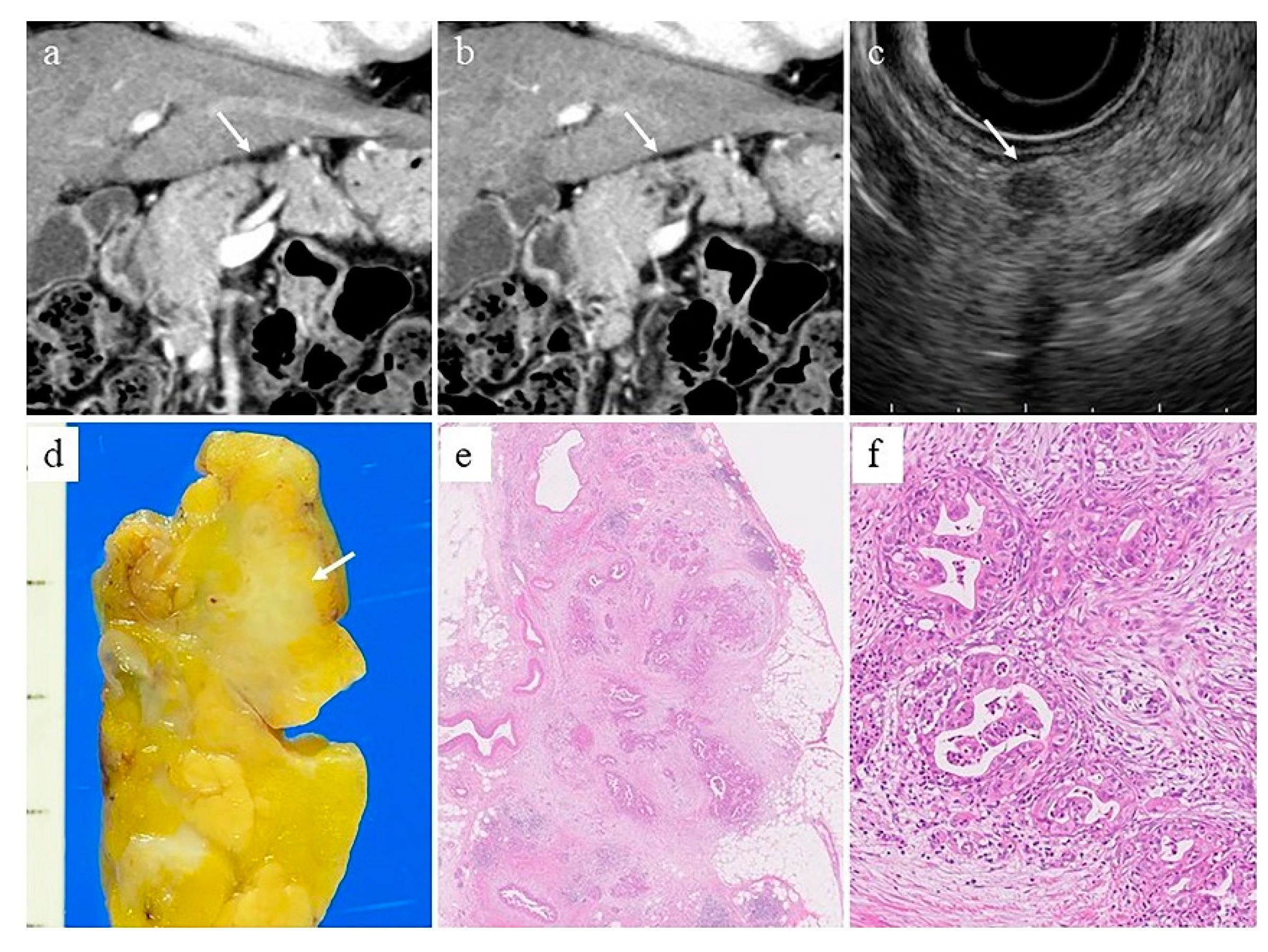 Diagnostics 11 00238 g001 Diagnostics 11 00238 g001