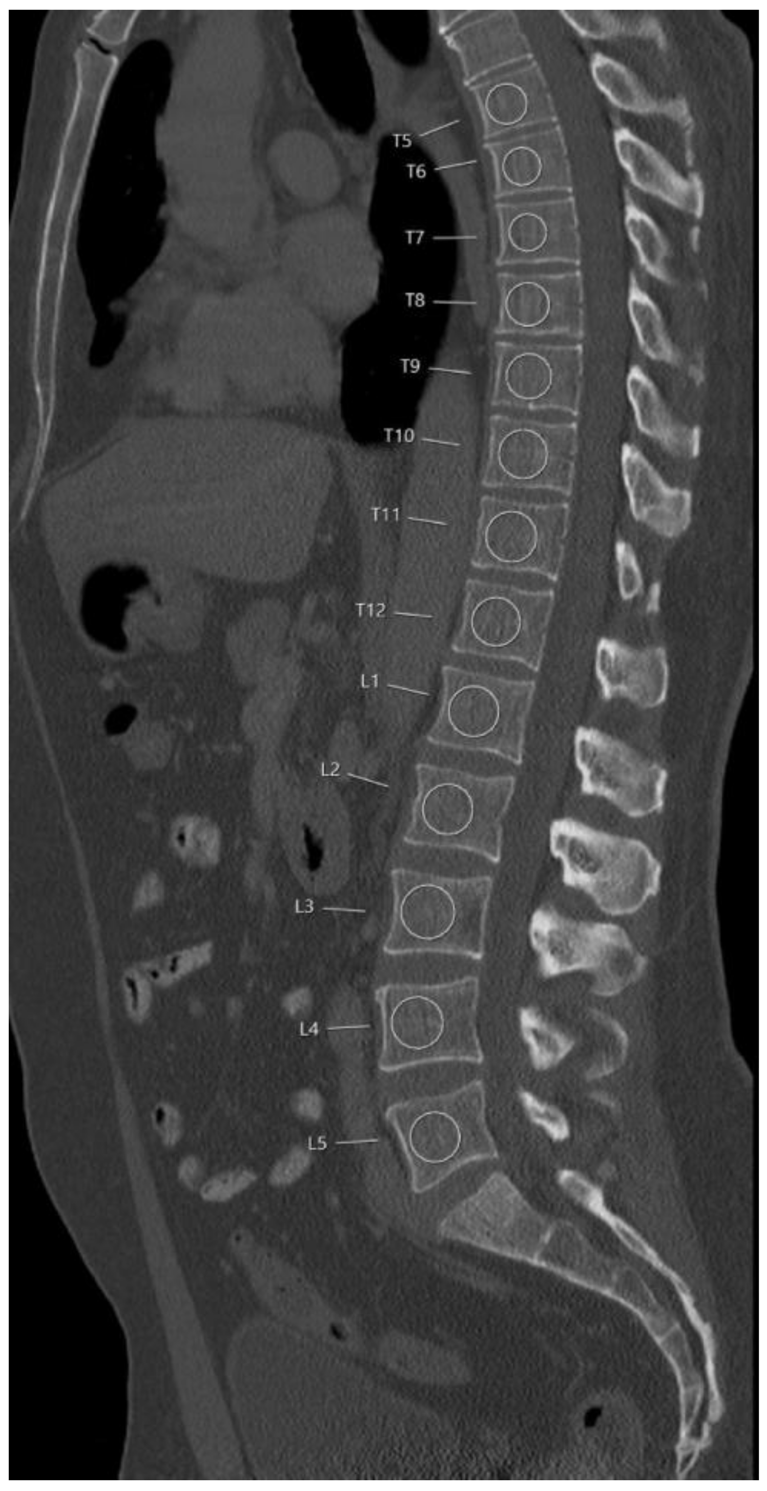 Diagnostics 11 00240 g001 Diagnostics 11 00240 g001
