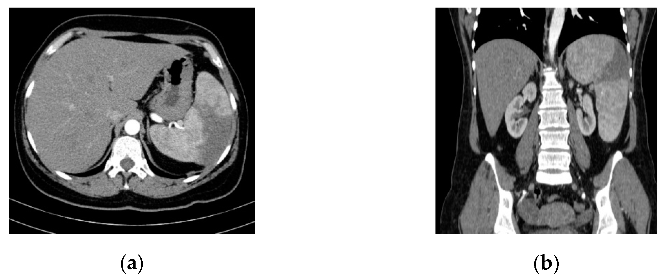 Diagnostics 11 00251 g001 Diagnostics 11 00251 g001