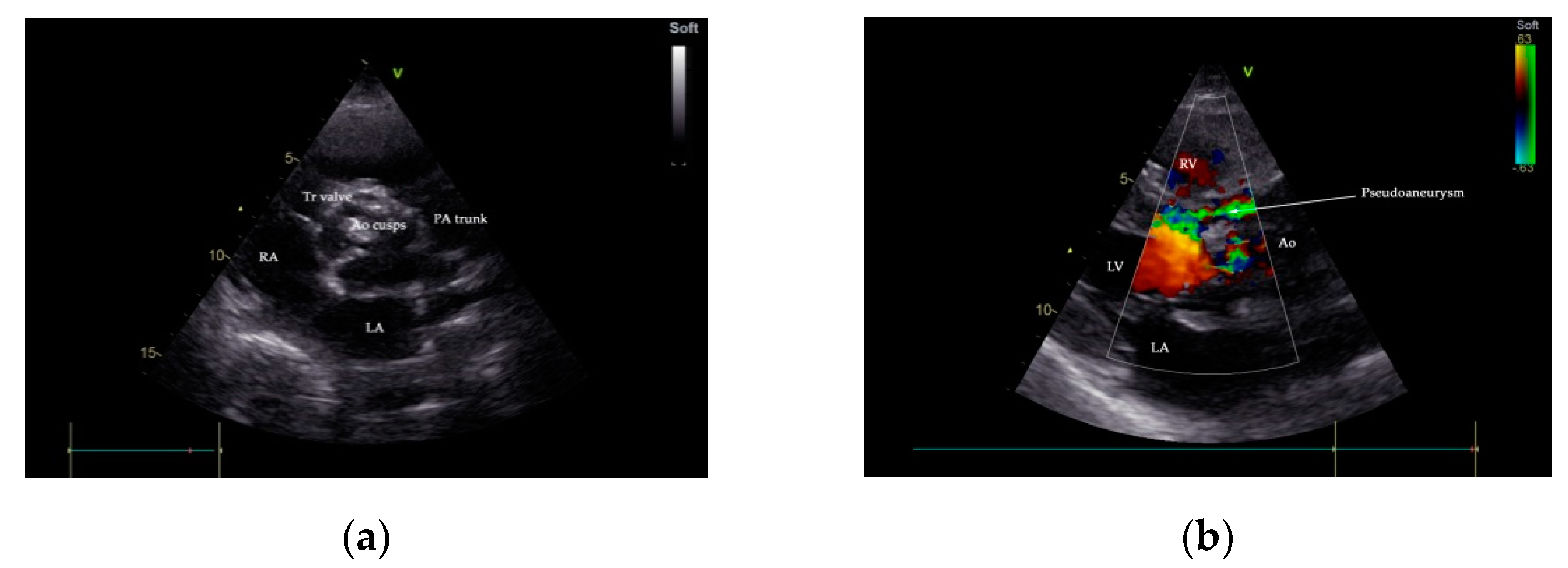 Diagnostics 11 00251 g002 Diagnostics 11 00251 g002