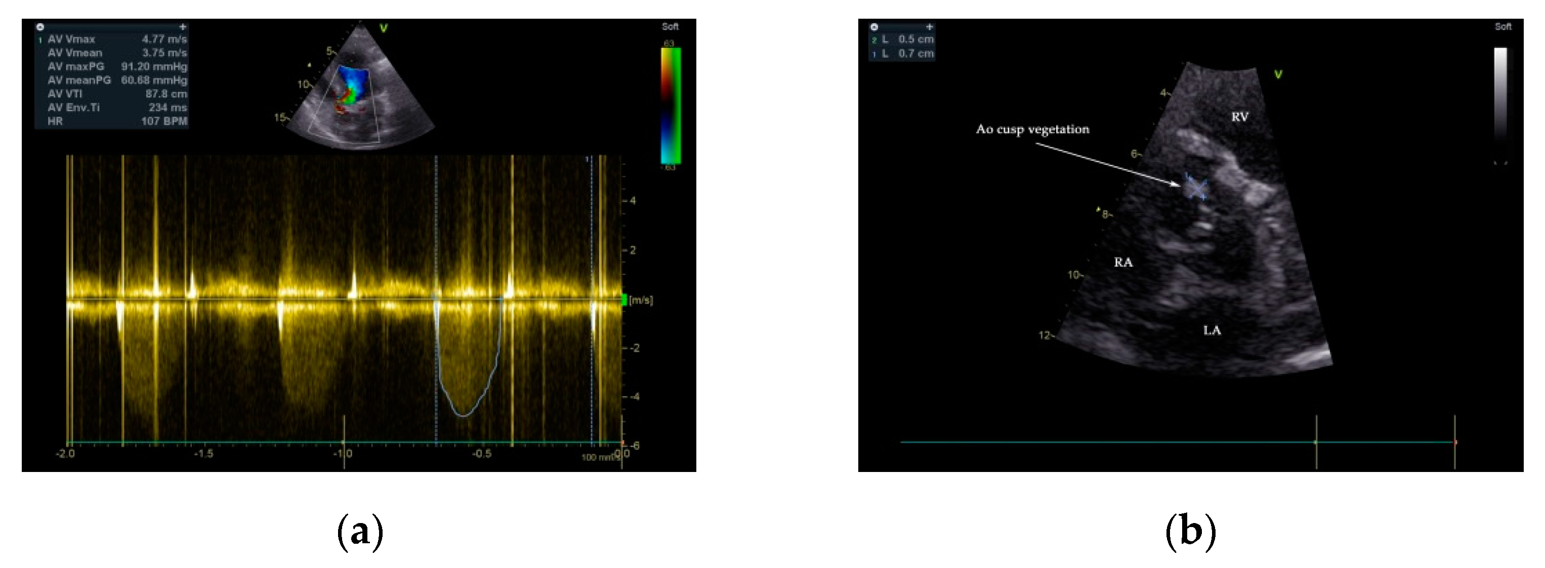 Diagnostics 11 00251 g003 Diagnostics 11 00251 g003
