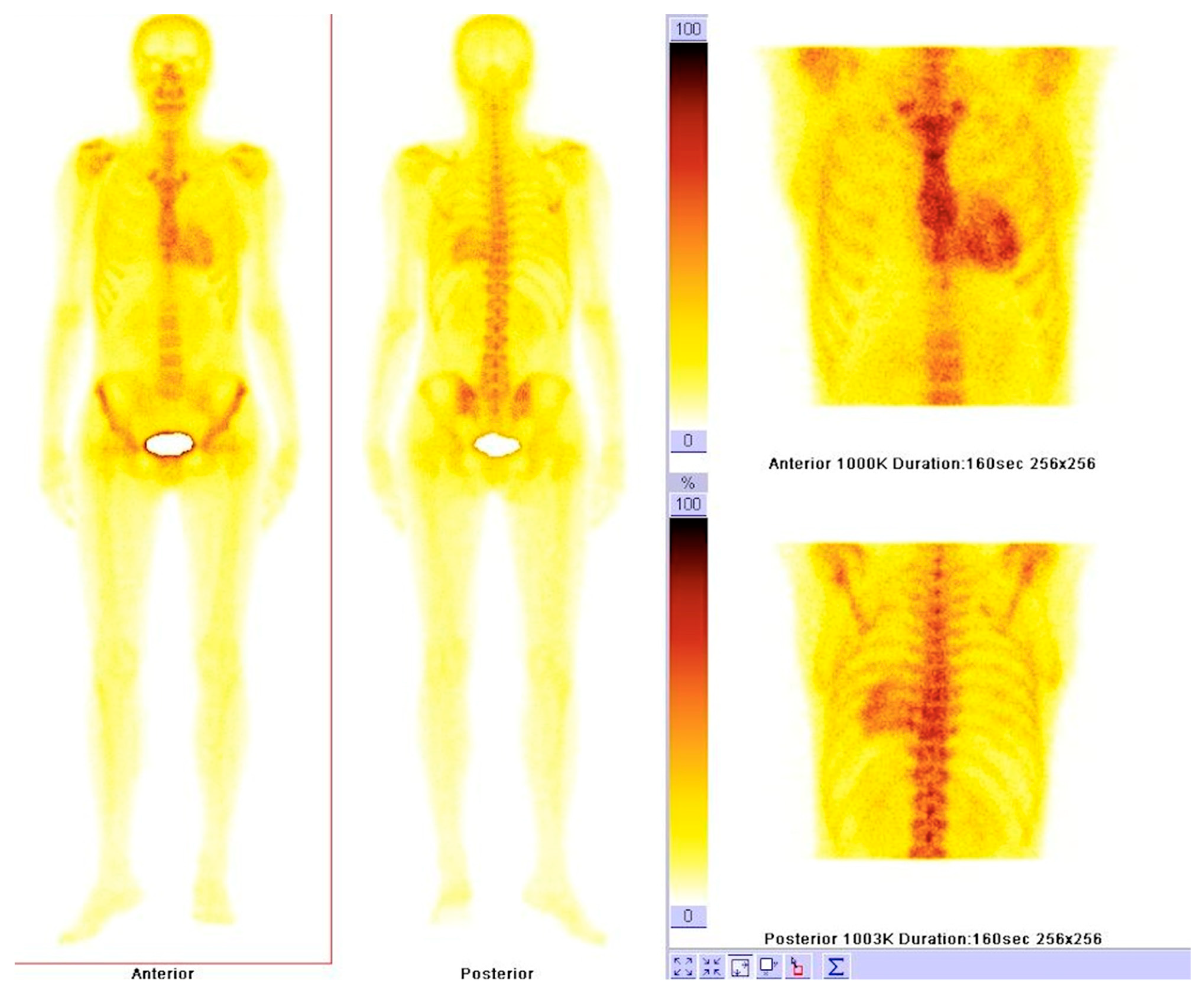 Diagnostics 11 00256 g006