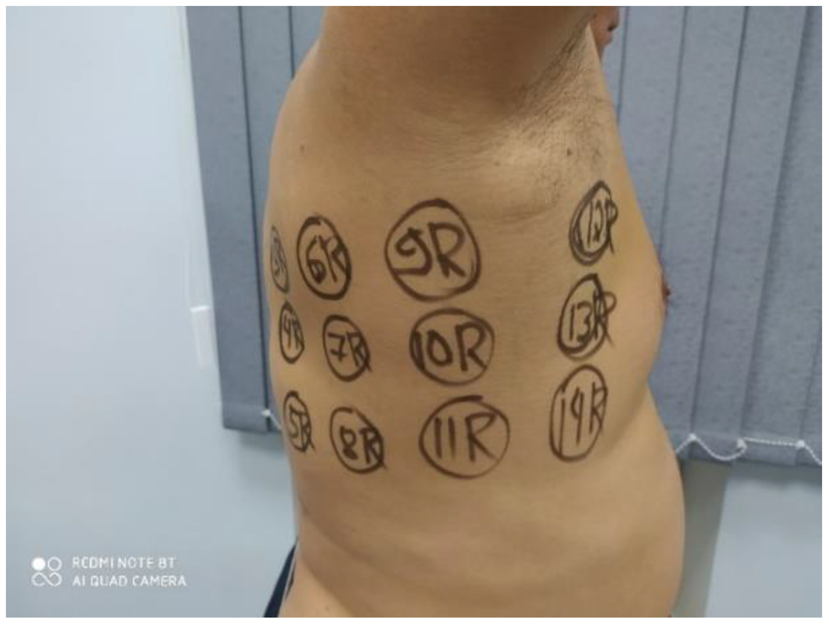 Diagnostics 11 00259 g004