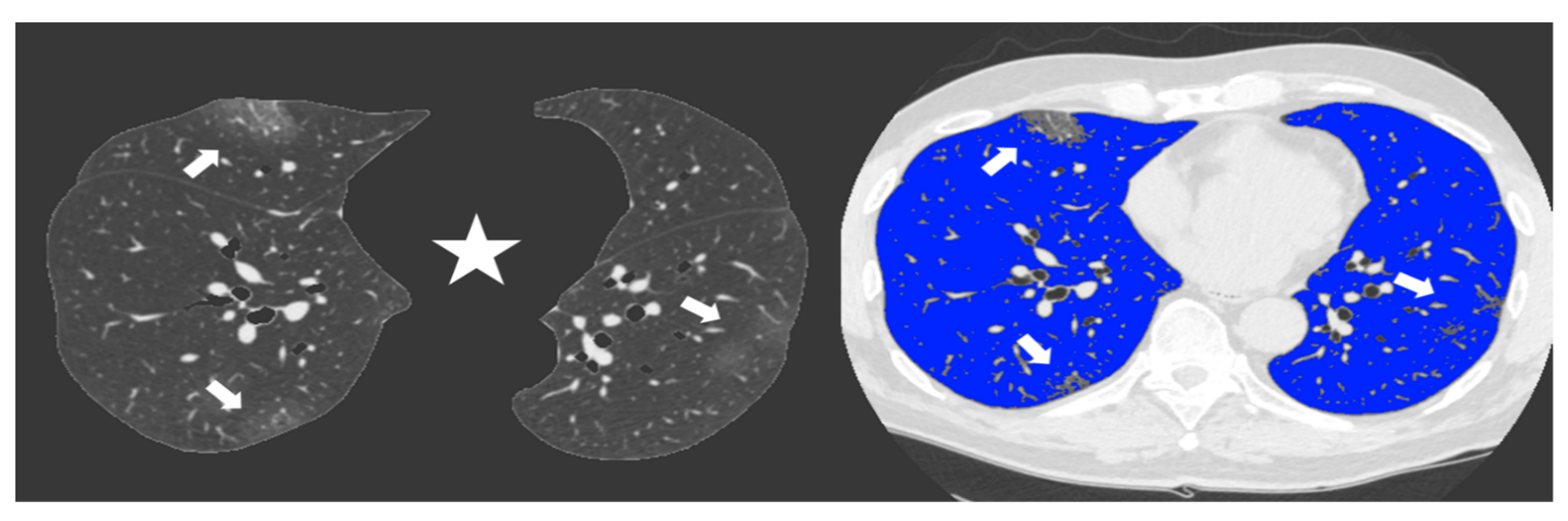 Diagnostics 11 00265 g003