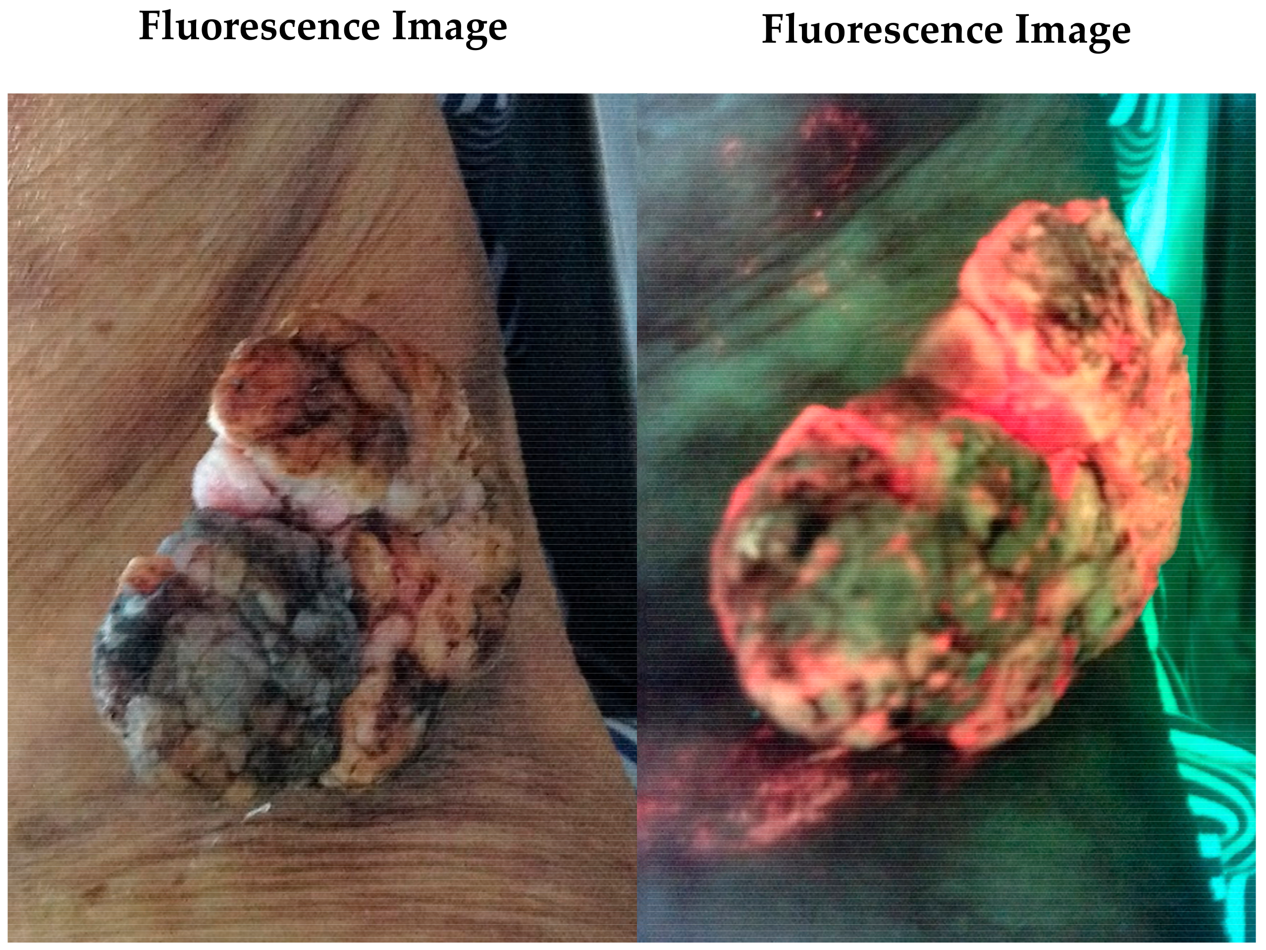 Diagnostics 11 00268 g003