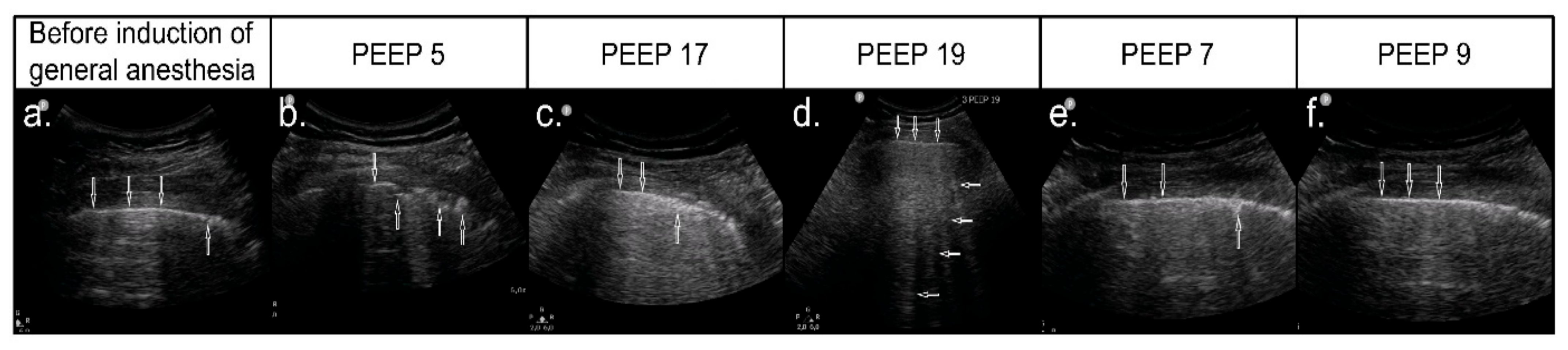 Diagnostics 11 00276 g004