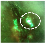 Diagnostics 11 00280 i001