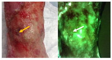 Diagnostics 11 00280 i002