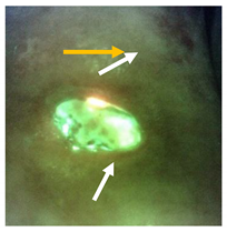 Diagnostics 11 00280 i003