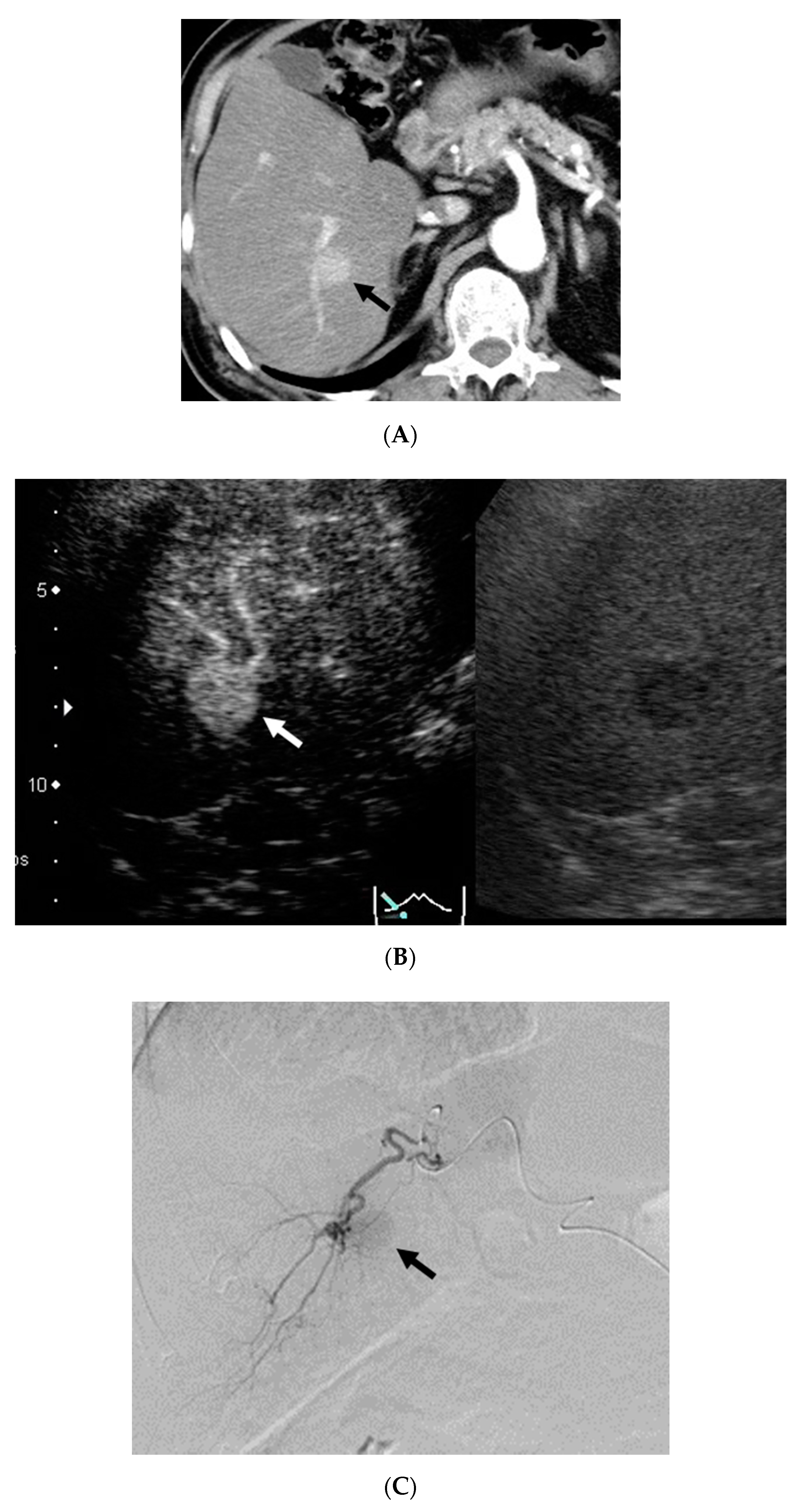 Diagnostics 11 00291 g002a