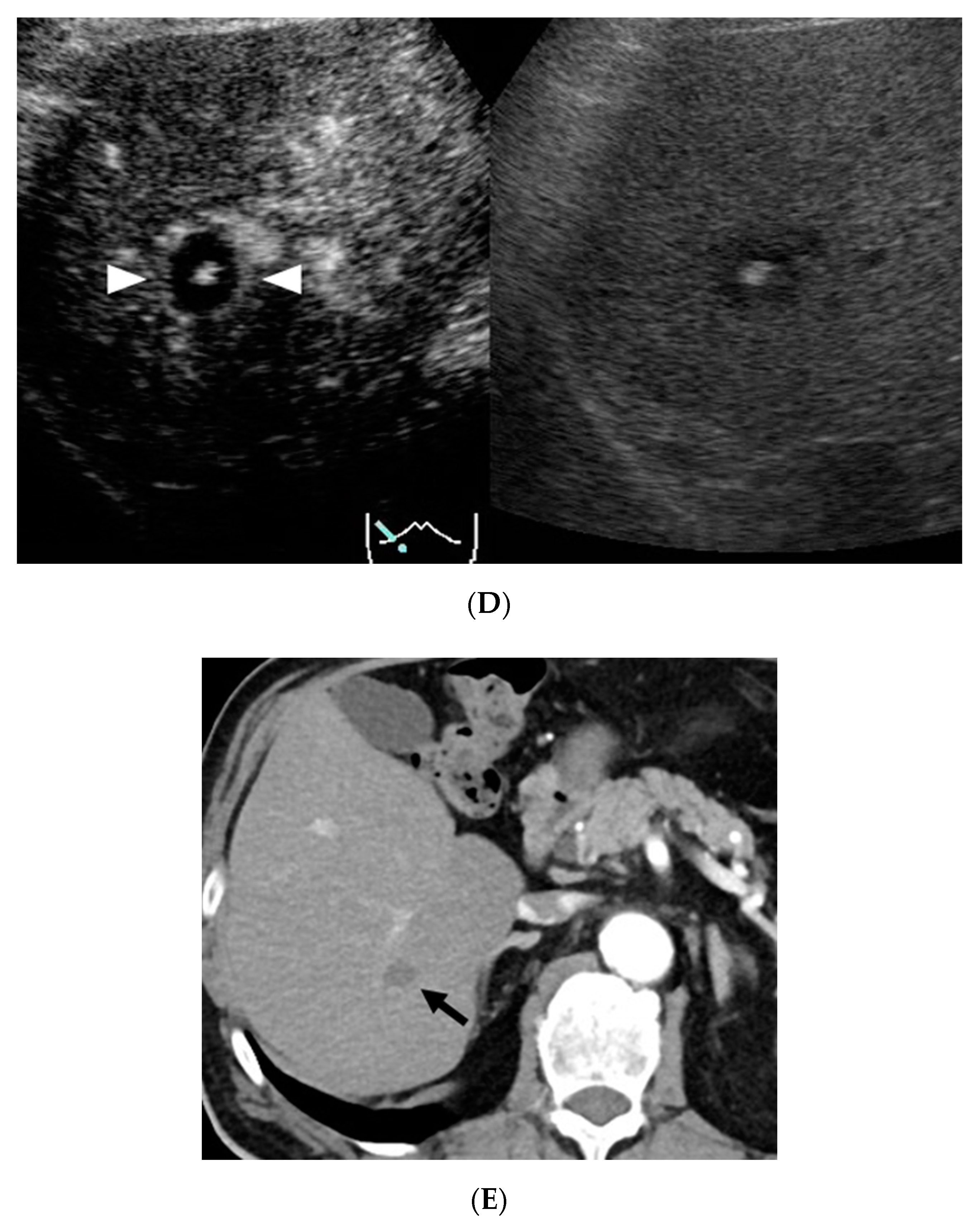 Diagnostics 11 00291 g002b