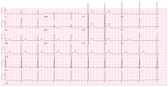 Diagnostics 11 00295 g001
