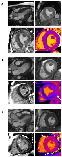 Diagnostics 11 00295 g004