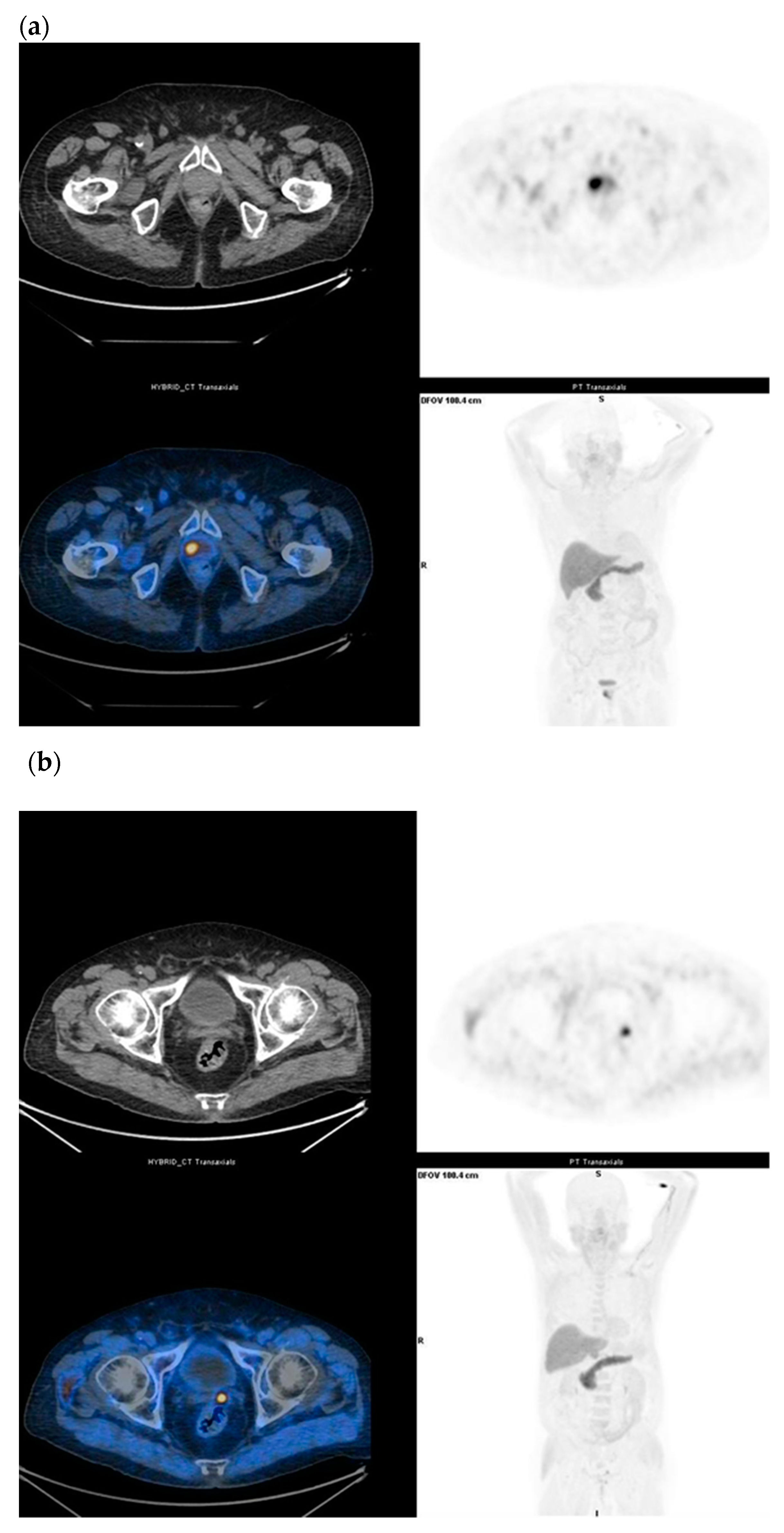 Diagnostics 11 00304 g005