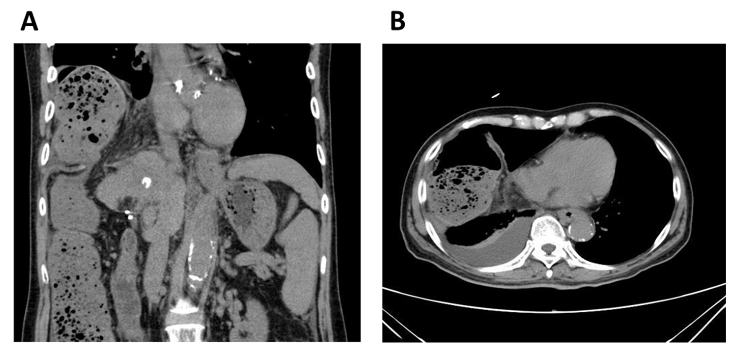 Diagnostics 11 00307 g001