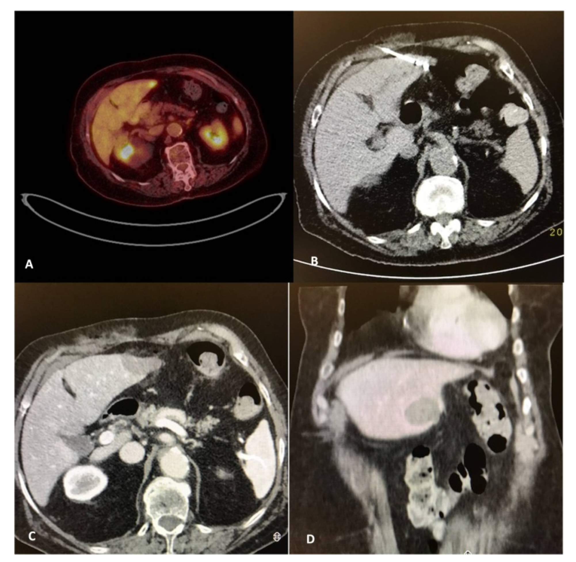 Diagnostics 11 00308 g002