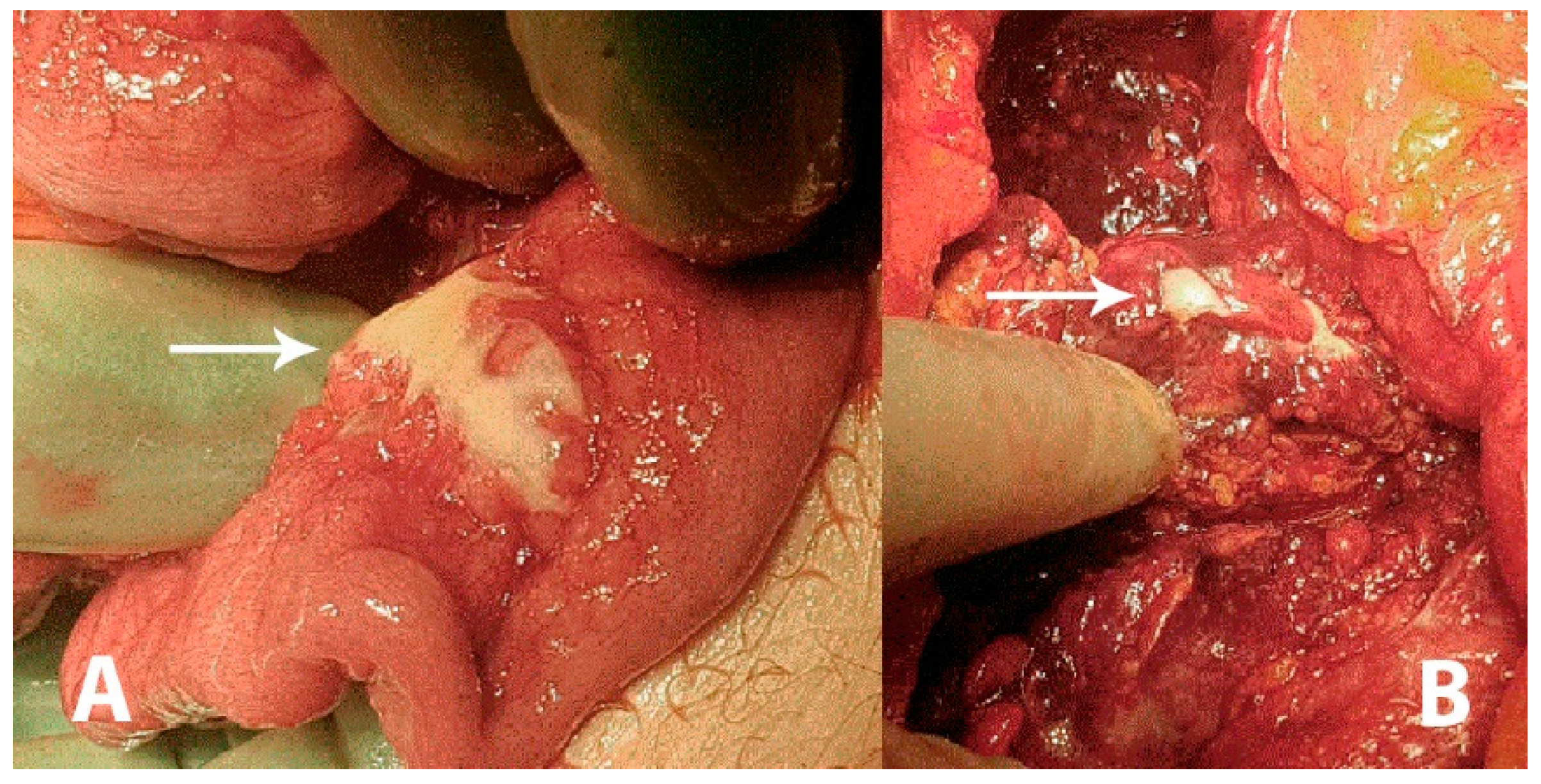 Diagnostics 11 00310 g001