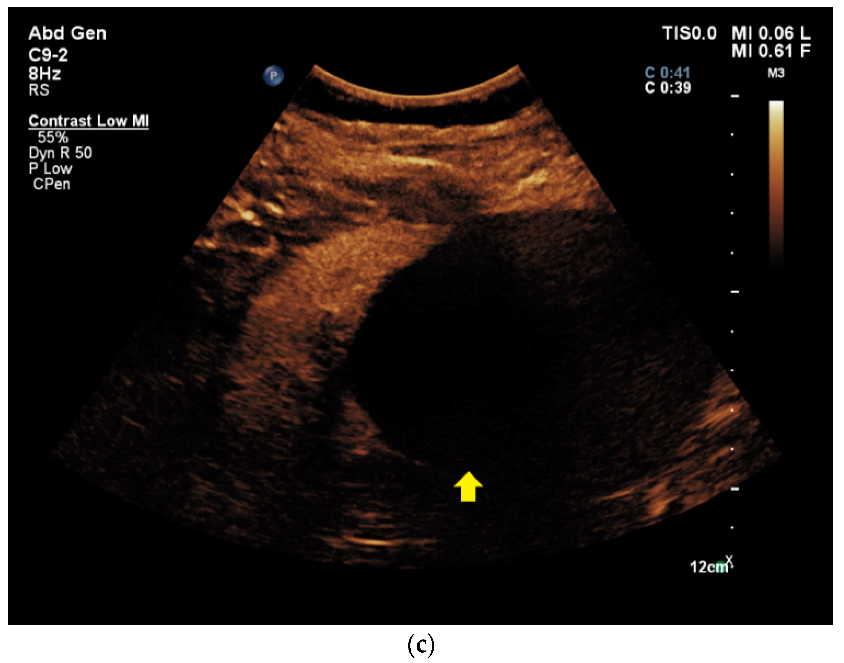 Diagnostics 11 00313 g002b